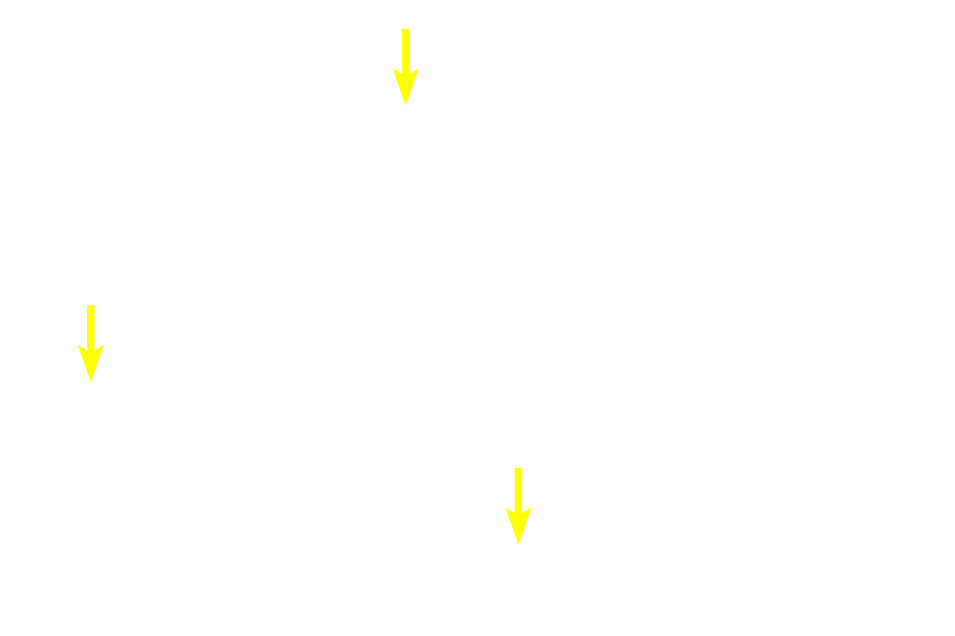 - Blood vessels <p>Lamellar (mature) bone is organized in lamellae with orderly arranged, flattened lacunae between them. This organization gives lamellar bone more strength. In the bone shown here, the lamellae are arranged as cylindrical structures called Haversian systems or osteons with a central Haversian canal. This canal is lined by an endosteum and contains one or more blood vessels.  On the surface of bones, lamellae are arranged as flattened plates.</p>
