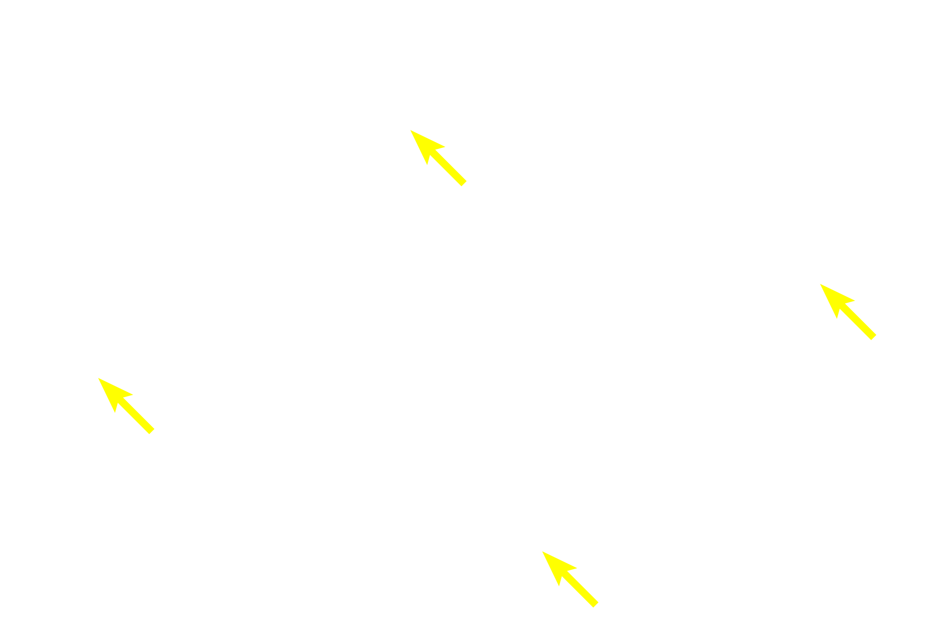  - Haversian canals <p>Lamellar (mature) bone is organized in lamellae with orderly arranged, flattened lacunae between them. This organization gives lamellar bone more strength. In the bone shown here, the lamellae are arranged as cylindrical structures called Haversian systems or osteons with a central Haversian canal. This canal is lined by an endosteum and contains one or more blood vessels.  On the surface of bones, lamellae are arranged as flattened plates.</p>
