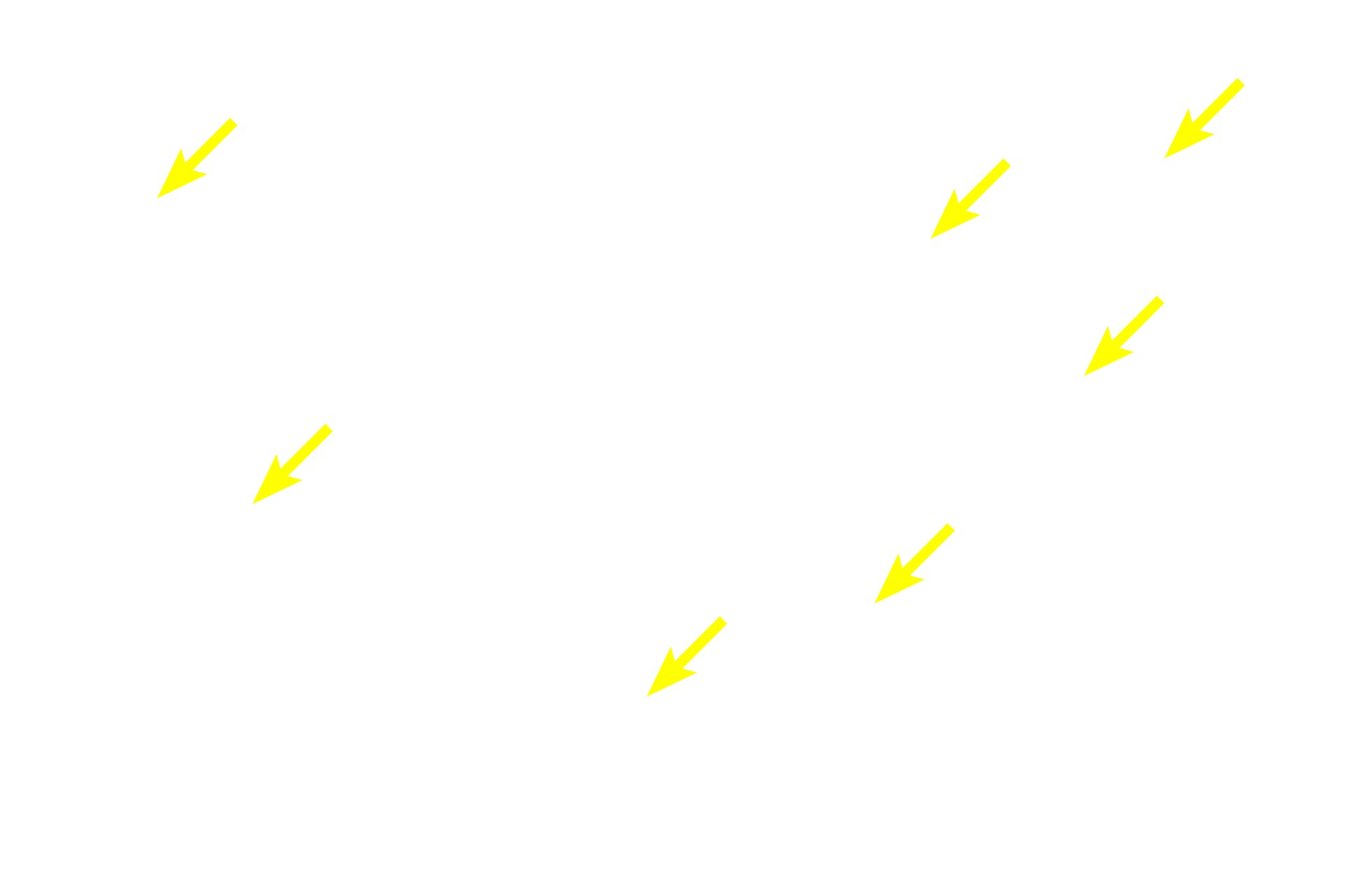Osteocytes <p>This tissue, composed of both woven and lamellar bone, represents a later stage in bone formation. During bone formation, the first bone produced is woven bone that is gradually remodeled into lamellar bone. As a result, some areas will be composed of both woven and lamellar bone, as seen here. Similar events occur during adult remodeling and repair following a fracture.  600x</p>
