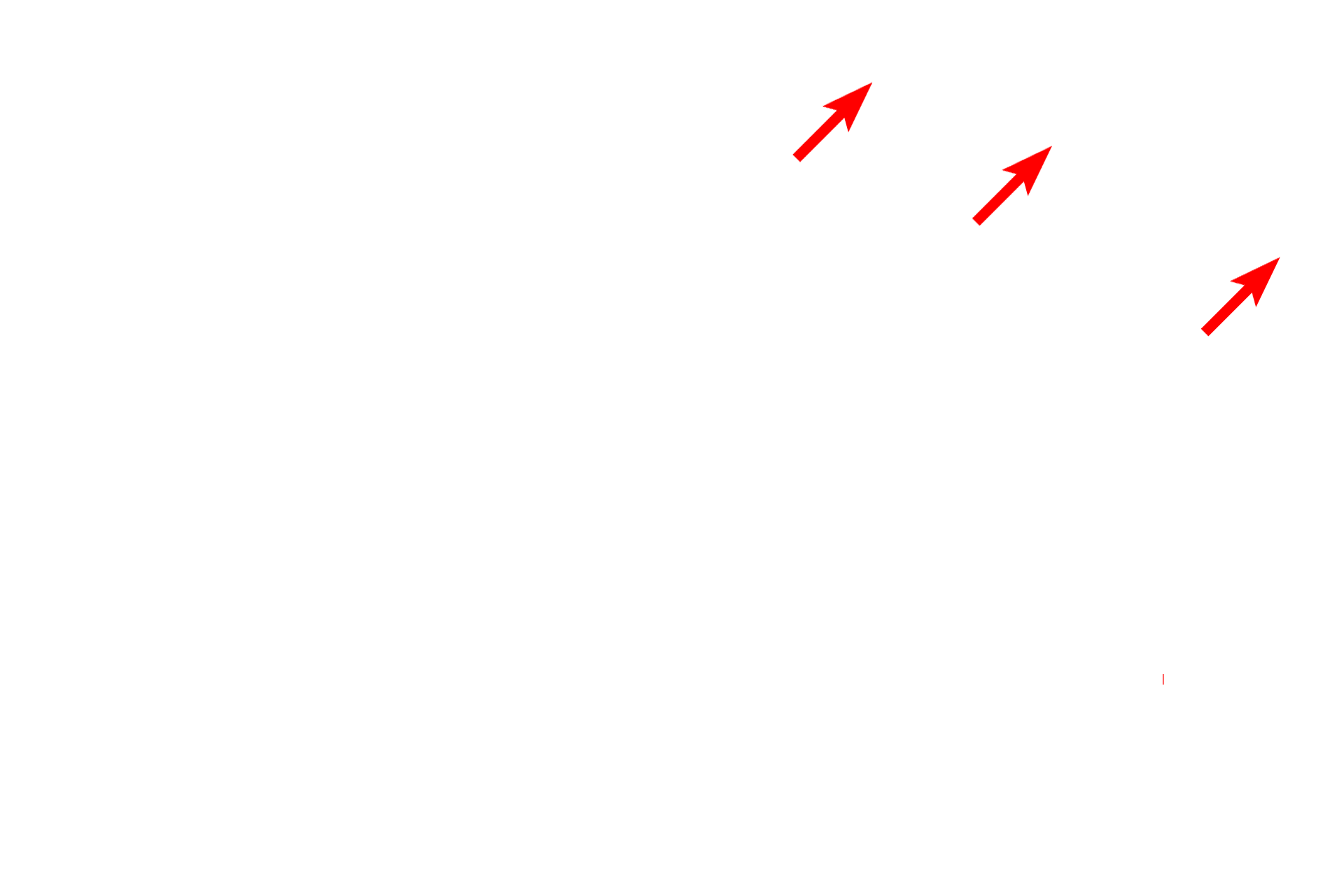 Nutritive canal > <p>Bone is a highly vascular tissue, containing a complex system of interconnected tunnels in the matrix to accommodate the passage of blood vessels. Vessels enter the bone through nutritive foramina, travel in nutritive canals and branch repeatedly, extending longitudinally and horizontally in Haversian and Volkmann’s canals. Haversian, Volkmann’s and nutritive canals are all lined by endosteum.</p>
