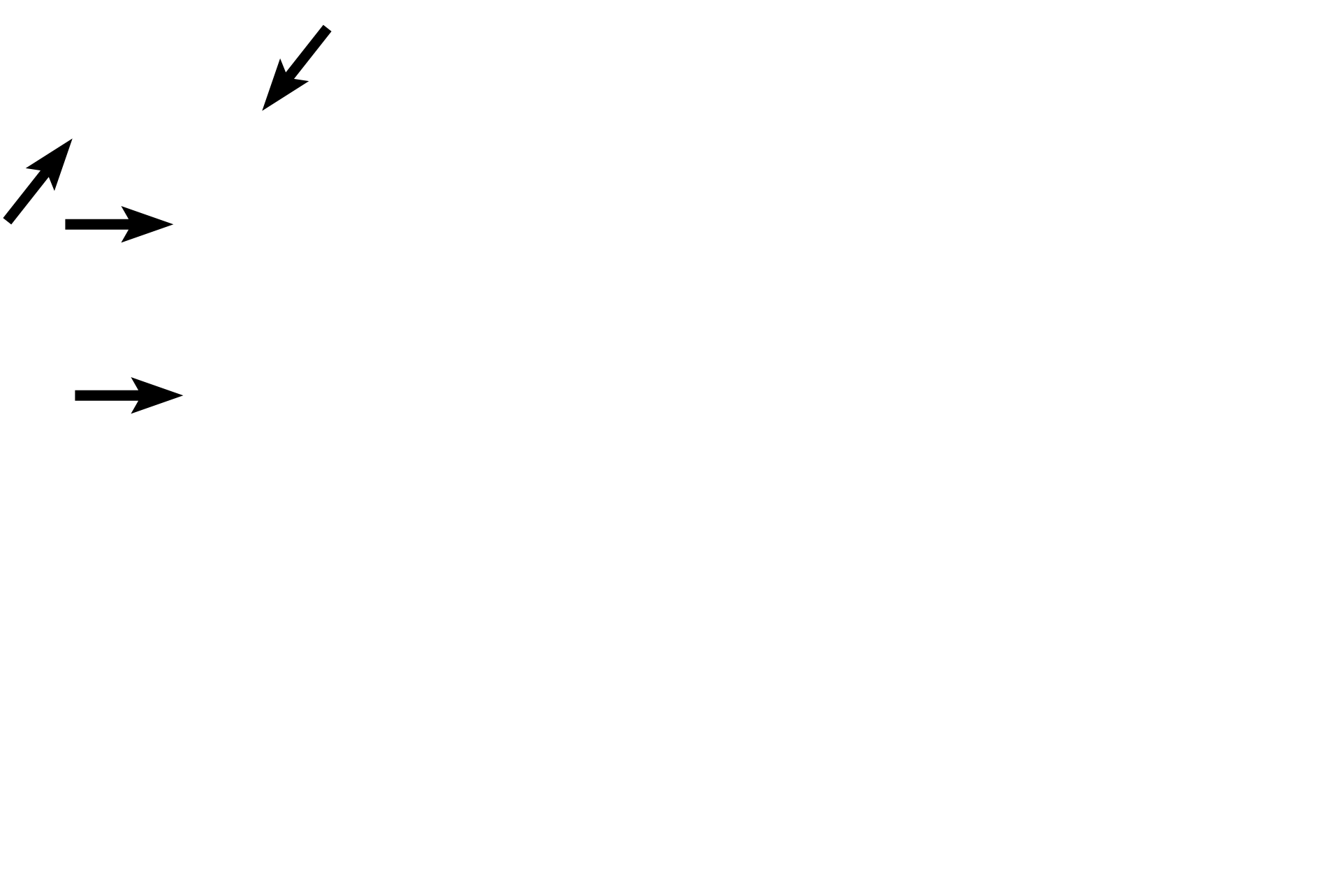 Compact bone >  <p>Compact bone, also called cortical bone, is present as a thin shell over the surface of the epiphyses as well as forming a solid mass, comprising the shaft (diaphysis) of long bones. </p>
