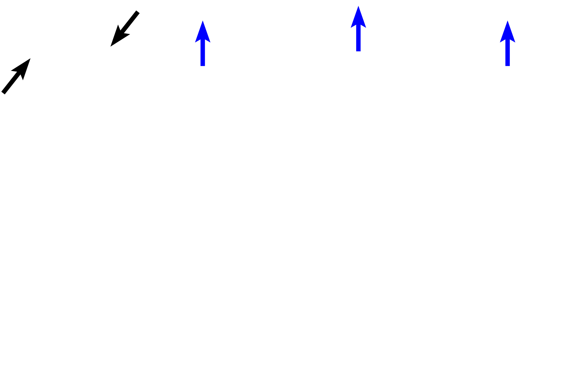  - Epiphysis > <p>A thin shell of compact bone covers the surface of the epiphysis.</p>
