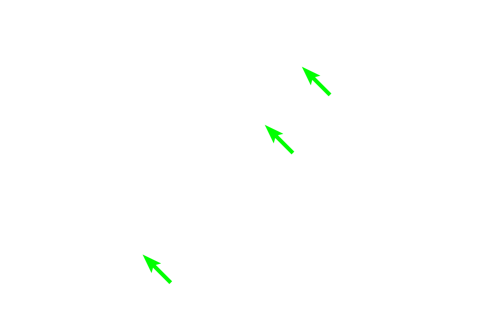 Osteocytes >  <p>Osteocytes are osteoblasts that have surrounded themselves with matrix and, therefore, lie within (rather than on) bone. Although not visible here, numerous processes radiate out from each cell body, communicating with other osteocytes and with surface cells. Osteocytes lie within spaces called lacunae, seen here as a halo surrounding each cell body. Osteocytes maintain the bone matrix.</p>
