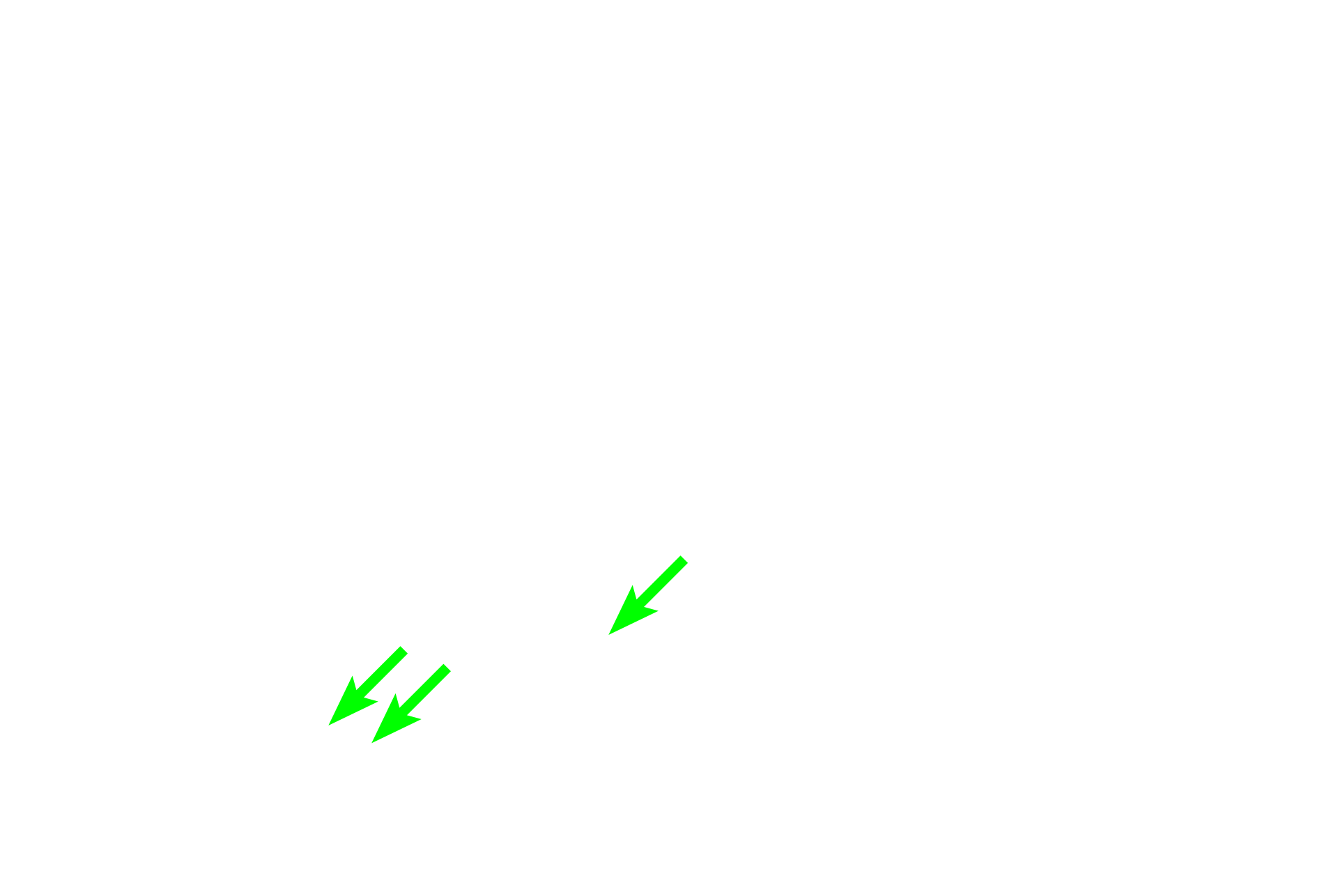  - Osteoid (organic matrix) >  <p>Formation of the extracellular matrix of bone begins with deposition of the organic portion, osteoid, by osteoblasts. Osteoid appears as a pale band on the bone surface immediately beneath the active osteoblasts and consists mainly of type I collagen fibrils. Type I collagen fibrils comprise about 90% of the total protein of osteoid and thus the matrix is highly eosinophilic. In addition to collagen, osteoid also contains proteoglycan aggregates. Osteoid rapidly becomes mineralized with calcium phosphate (hydroxyapatite). </p>
