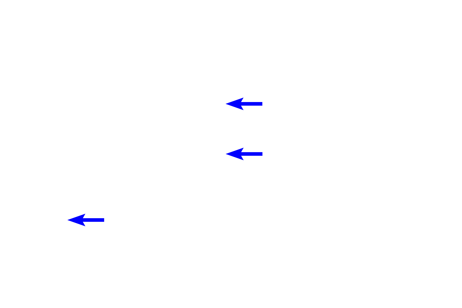  - Lacunae <p>Bone cells function to produce bone (osteoblasts), maintain bone (osteocytes) and degrade bone (osteoclasts). Each of these cell types is visible in this image of a decalcified, developing bone spicule. 400x</p>

