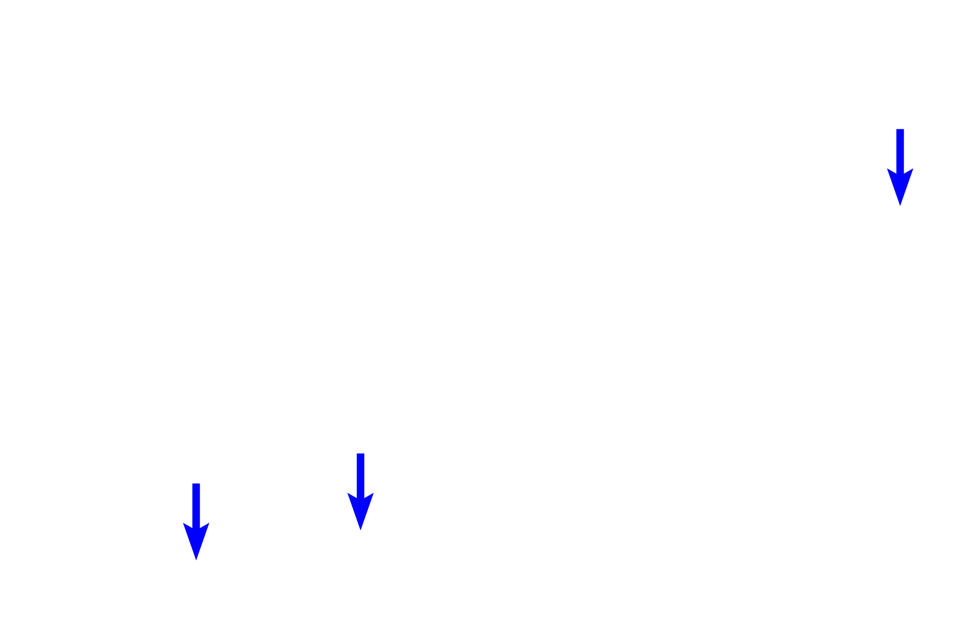 Osteoclasts <p>Bone cells function to produce bone (osteoblasts), maintain bone (osteocytes) and degrade bone (osteoclasts). Each of these cell types is visible in this image of a decalcified, developing bone spicule. 400x</p>
