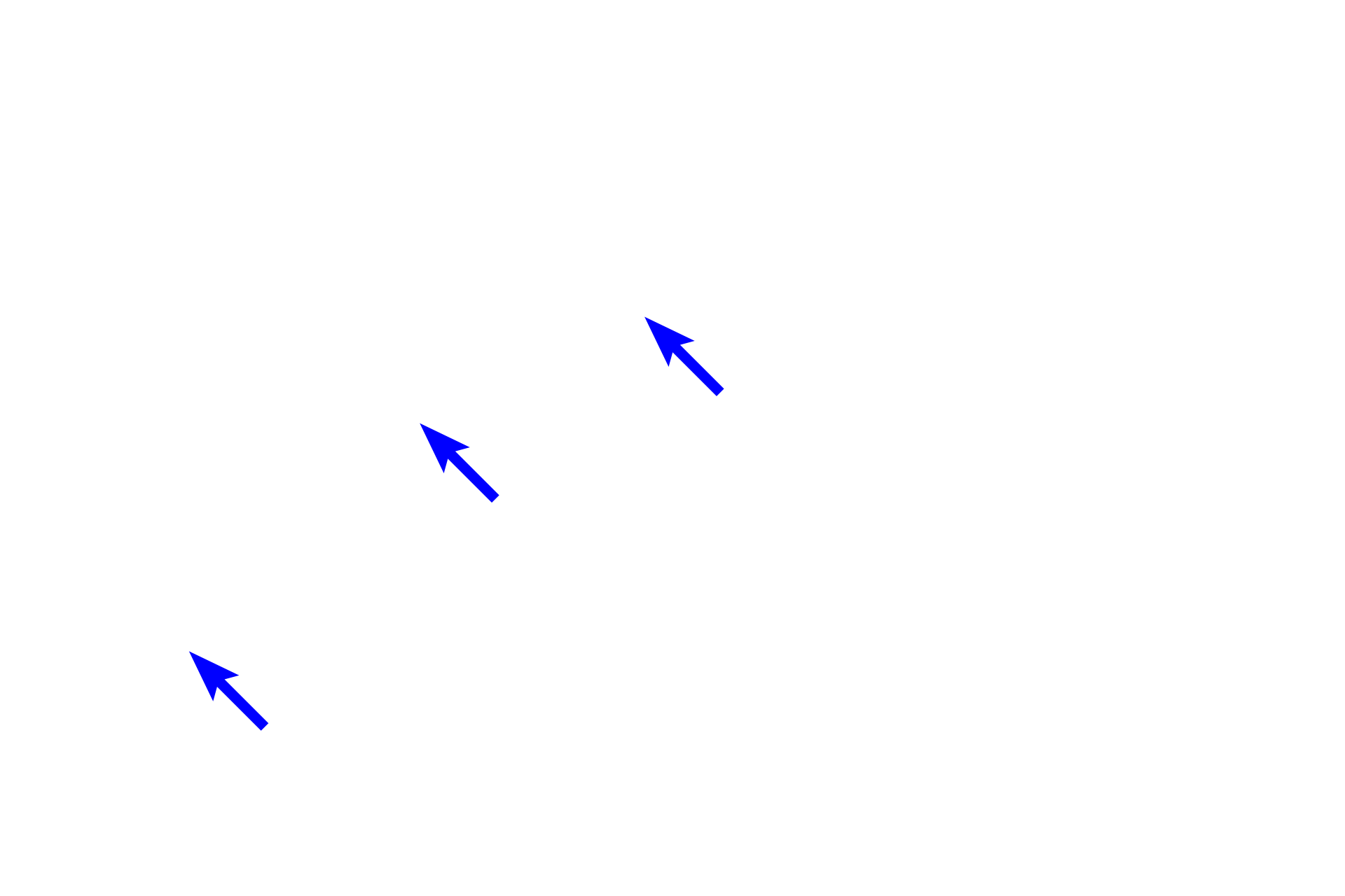 Osteocytes <p>Bone cells function to produce bone (osteoblasts), maintain bone (osteocytes) and degrade bone (osteoclasts). Each of these cell types is visible in this image of a decalcified, developing bone spicule. 400x</p>
