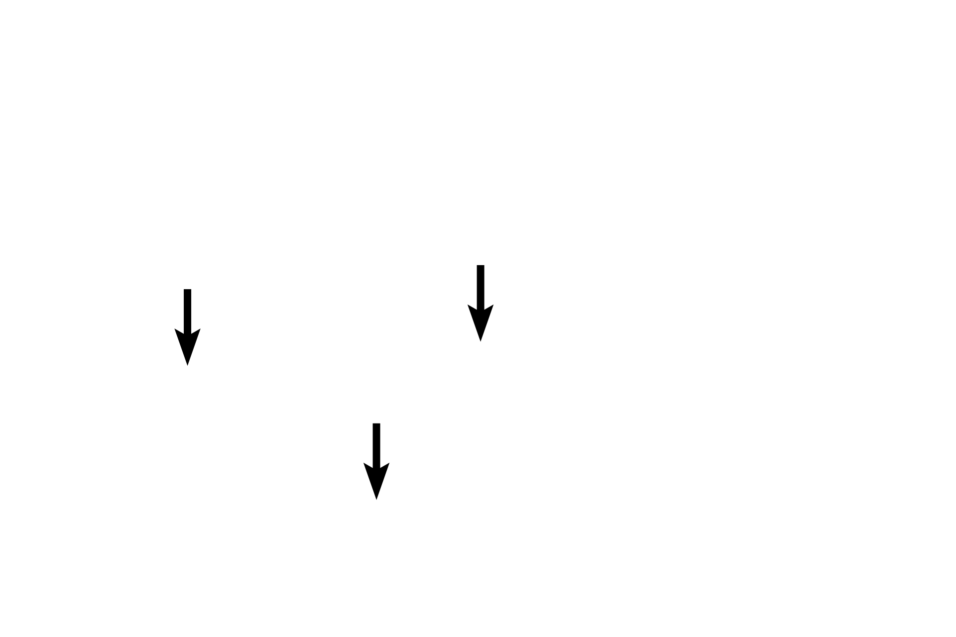 Osteocytes in lacunae <p>This spicule of bone is being resorbed by multiple osteoclasts, large, motile cells with multiple nuclei.  Throughout life, bone is resorbed and deposited to both renew and repair the matrix and to respond to mechanical stresses. Resorption results in the formation of depressions in the bone called Howship’s lacunae. Osteoclasts belong to the monocyte lineage and are not related to osteoblasts or osteocytes.  Spongy bone, 600x</p>
