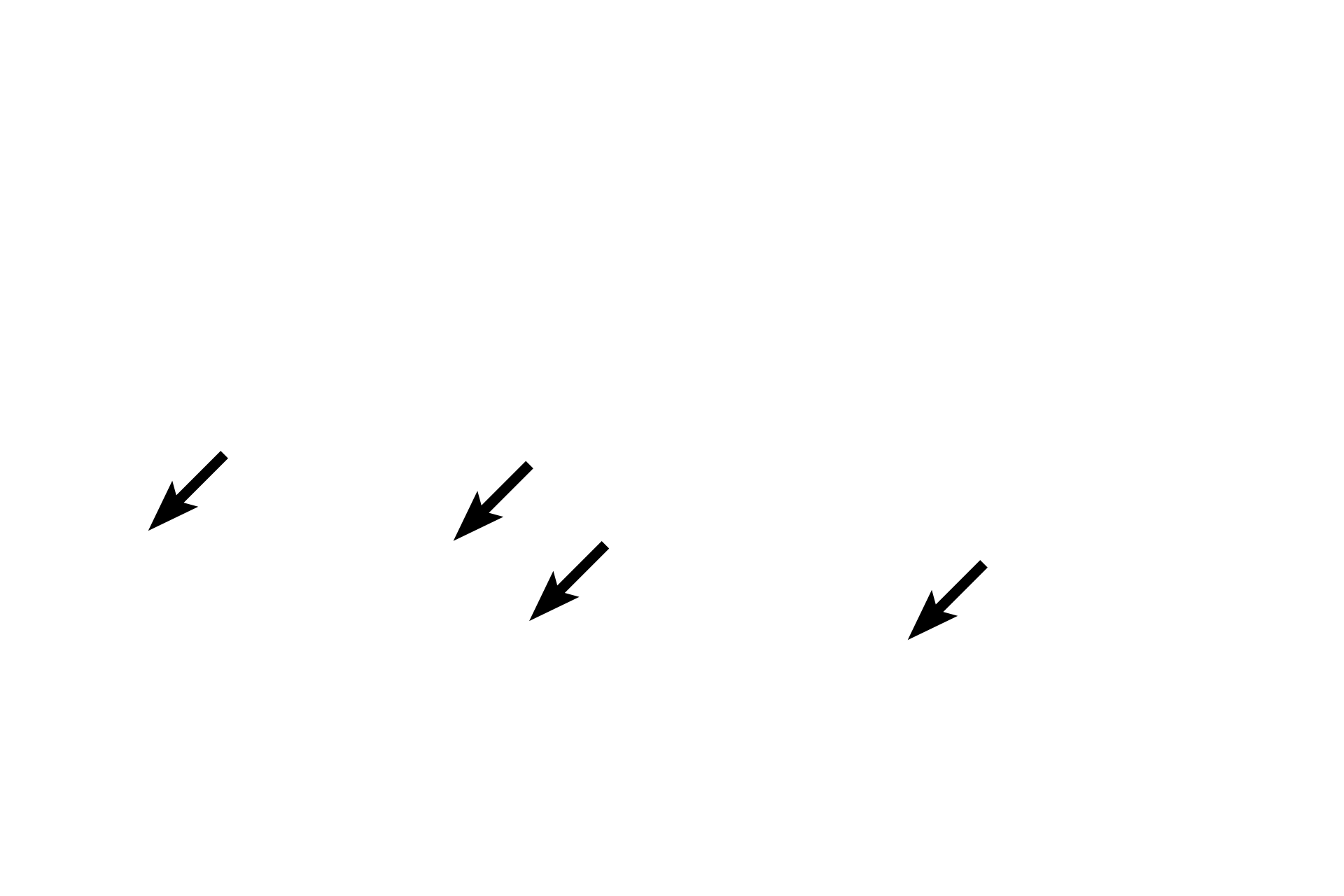  - Endosteum >  <p>Endosteum surrounds the individual spicules of spongy bone and will continue to line all interior surfaces of the flat bone in the adult. As this is developing bone, large numbers of osteoblasts are present in the endosteum on the surface of the spicules.</p>
