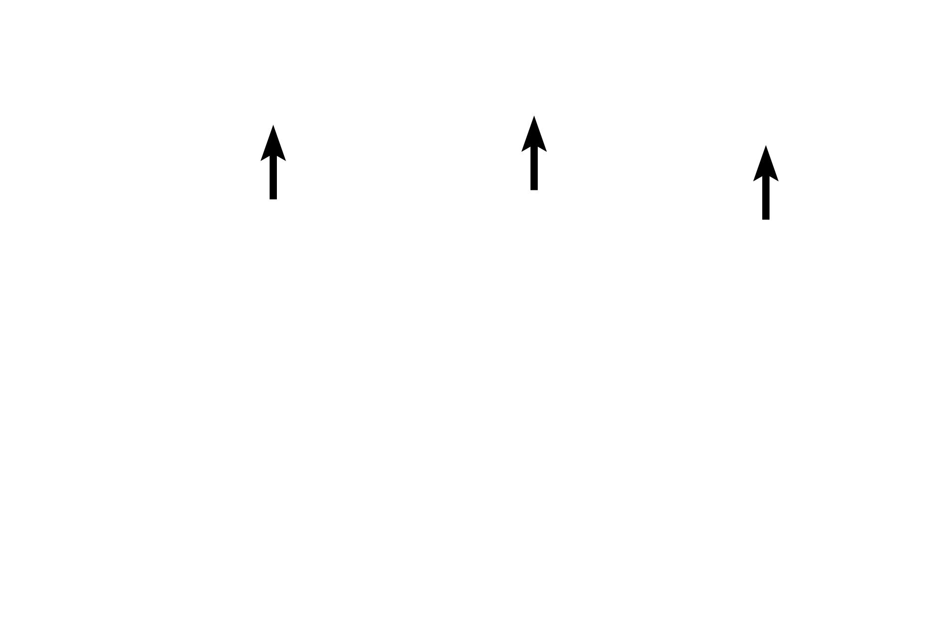  - Outer table <p>This dried cranial bone shows a layer of spongy bone (diploë), between inner and outer tables of compact bone.</p>
