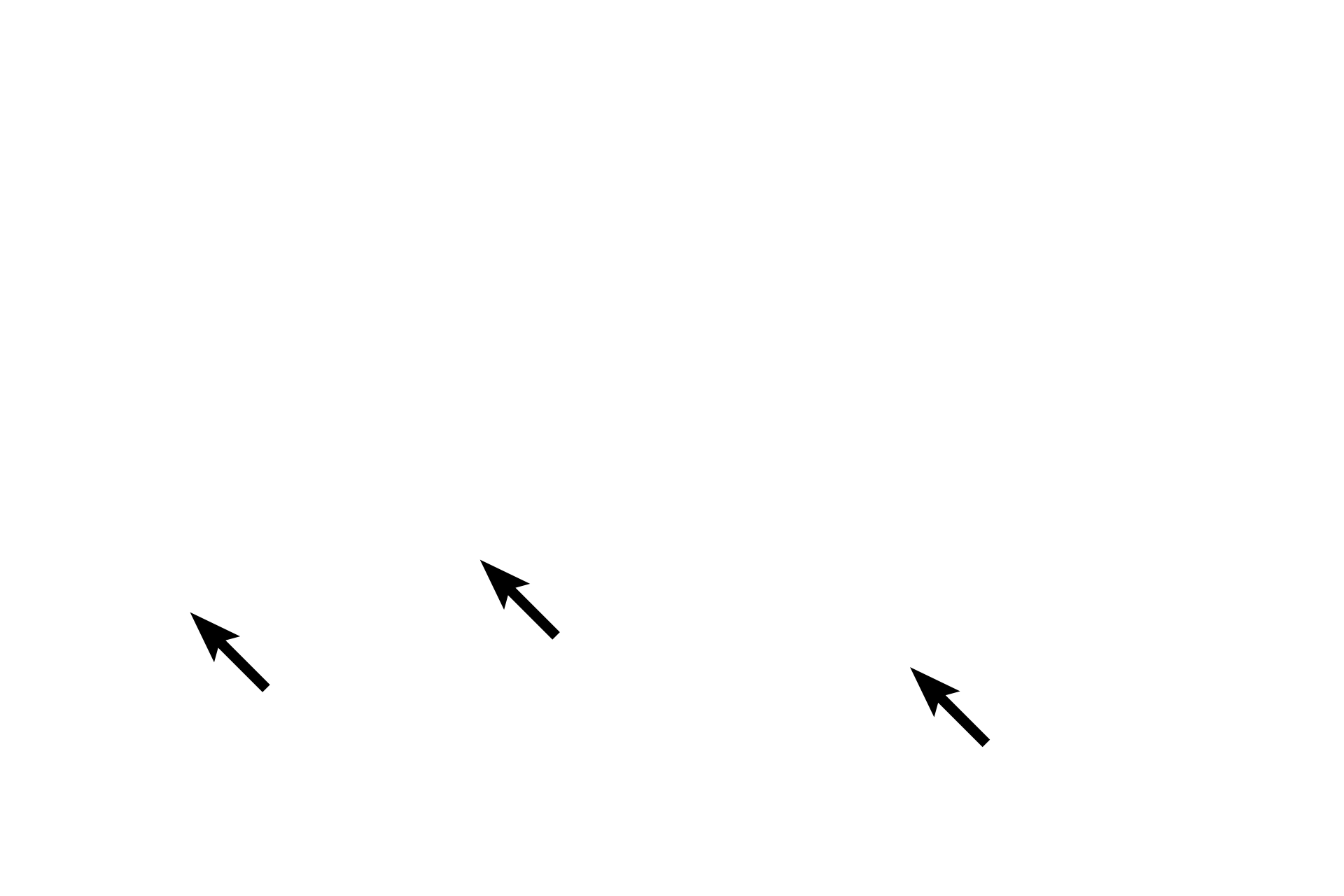  - Spicules >  <p>Spicules initially consists of woven bone that is gradually remodeled into lamellar, spongy bone forming the diploë in the adult. </p>
