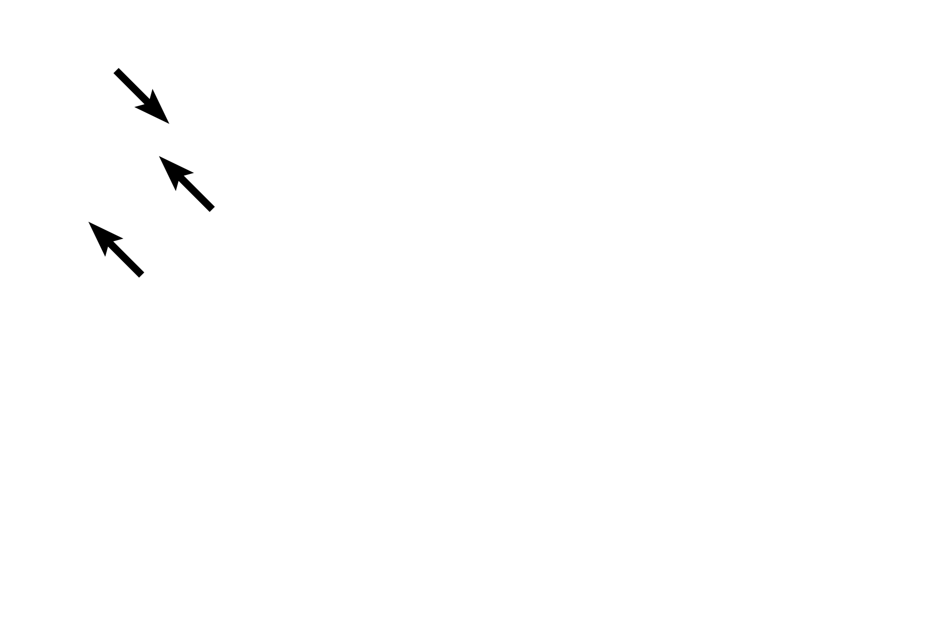  - Suture > <p>Where cranial bones meet, they form suture joints, consisting of a thin layer of fibrous connective tissue between the bones. Suture (fibrous) joints are immobile or only slightly mobile. The connective tissue is not preserved in this dried specimen and so a gap is visible between the bones.</p>
