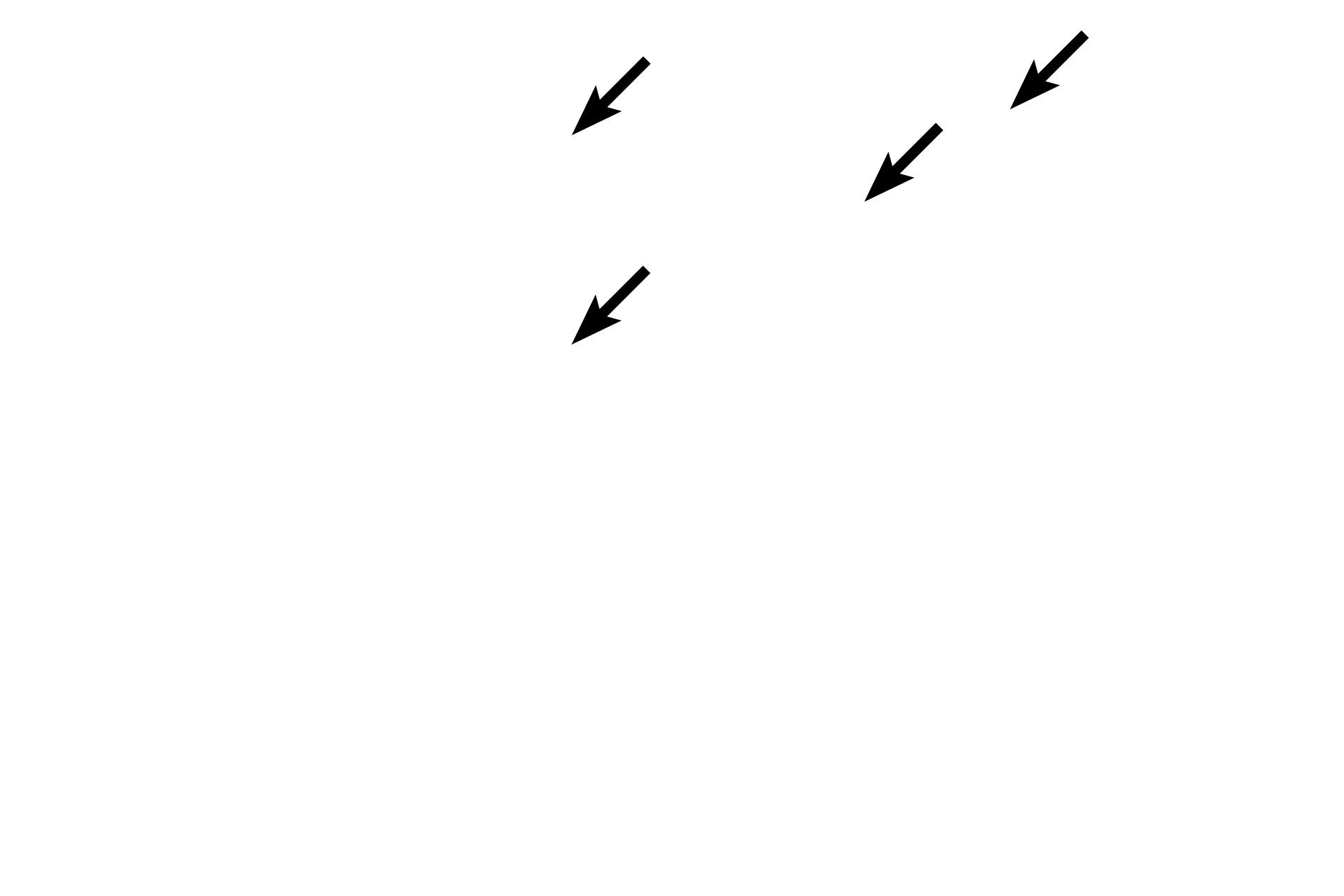 Endosteum >  <p>The endosteum lines the marrow cavity and also extends to line the nutritive foramen, Haversian canals and Volkmann’s canals.  Endosteum is not present in lacunae or canaliculi.</p>
