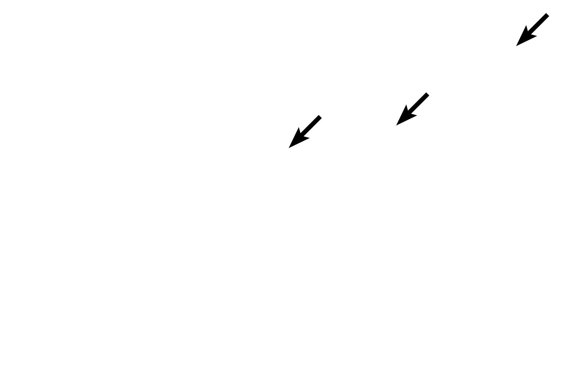 Endosteum >  <p>Within compact bone, endosteum lines Haversian and Volkmann’s canals.  It does not extend into lacunae or canaliculi.</p>
