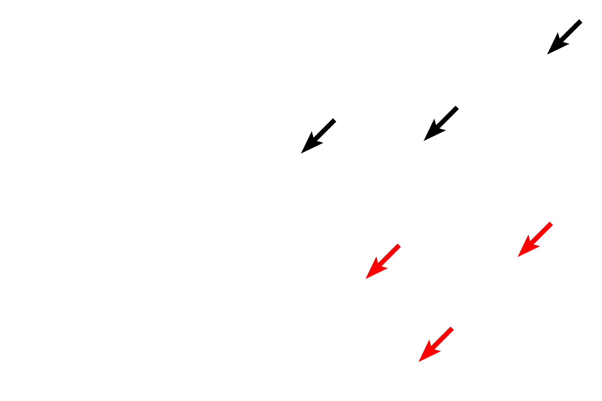  - Haversian canals <p>Compact bone forms the majority of the diaphysis and is seen in cross section of a decalcified bone preparation (above right) and in a ground bone preparation (below right). 200x, 200x</p>
