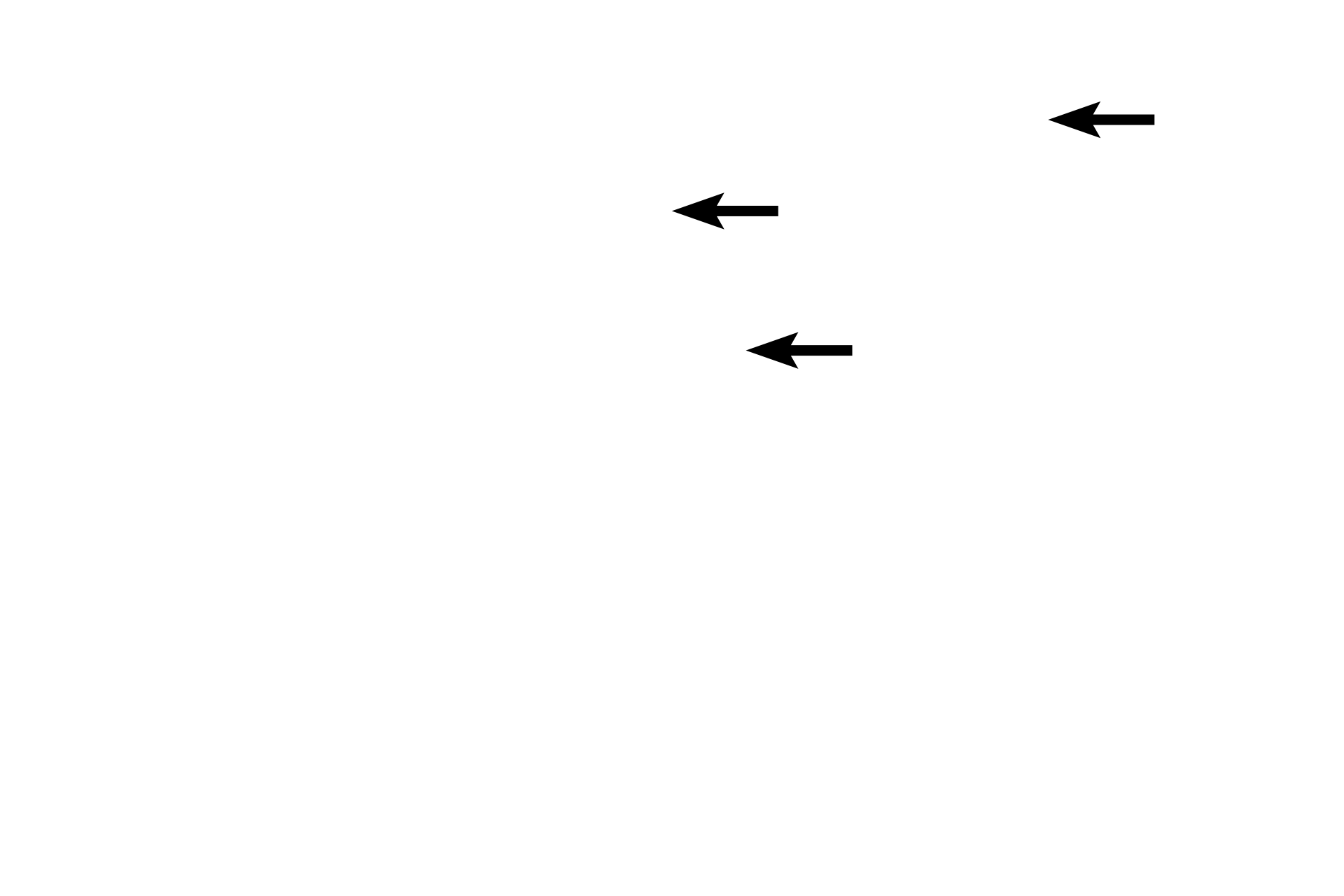 Osteocytes <p>Compact bone forms the majority of the diaphysis and is seen in cross section of a decalcified bone preparation (above right) and in a ground bone preparation (below right). 200x, 200x</p>
