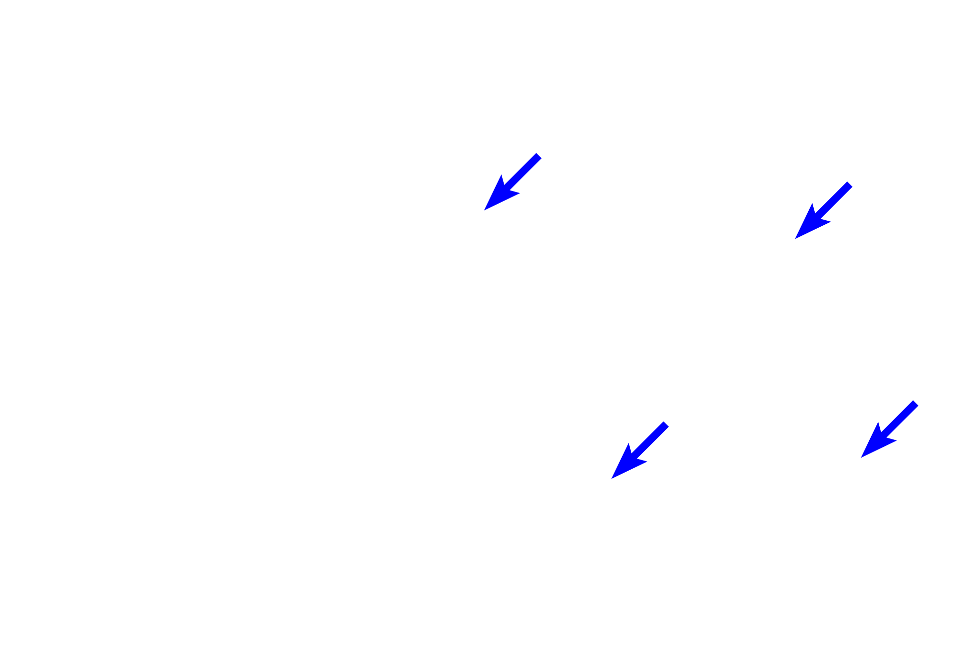  - Chondrocytes <p>The ends of long bones are covered by articular cartilage, formed of hyaline cartilage, providing a smooth, glassy surface that allows the ends of the bones to move easily on each other. This type of articulation is called a synovial joint. Articular cartilages, which are not covered by periosteum, are separated by a fluid-filled synovial space. A thin layer of compact bone lies beneath the cartilage.  10x, 800x  </p>
