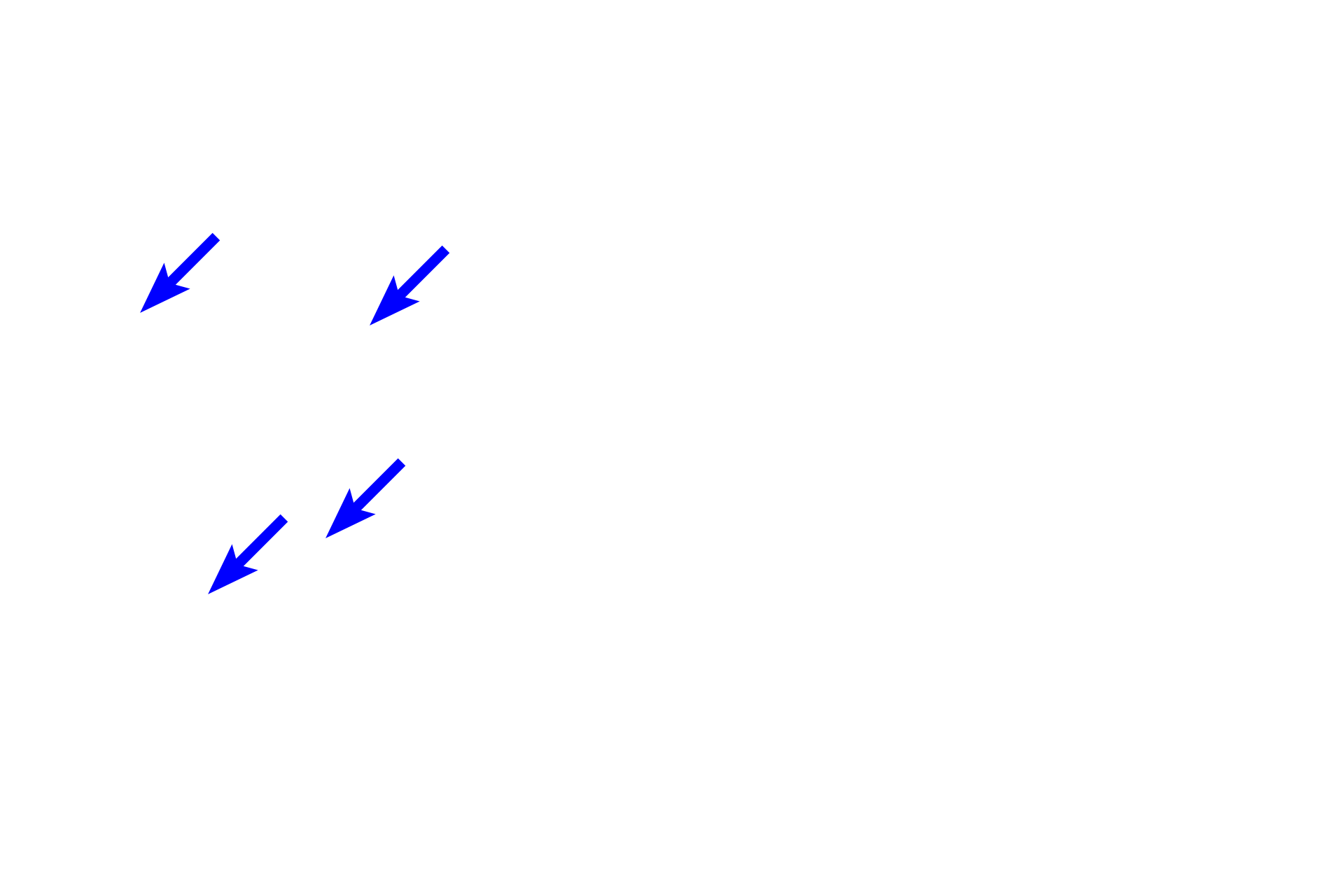 Spongy bone <p>The ends of long bones are covered by articular cartilage, formed of hyaline cartilage, providing a smooth, glassy surface that allows the ends of the bones to move easily on each other. This type of articulation is called a synovial joint. Articular cartilages, which are not covered by periosteum, are separated by a fluid-filled synovial space. A thin layer of compact bone lies beneath the cartilage.  10x, 800x   </p>
