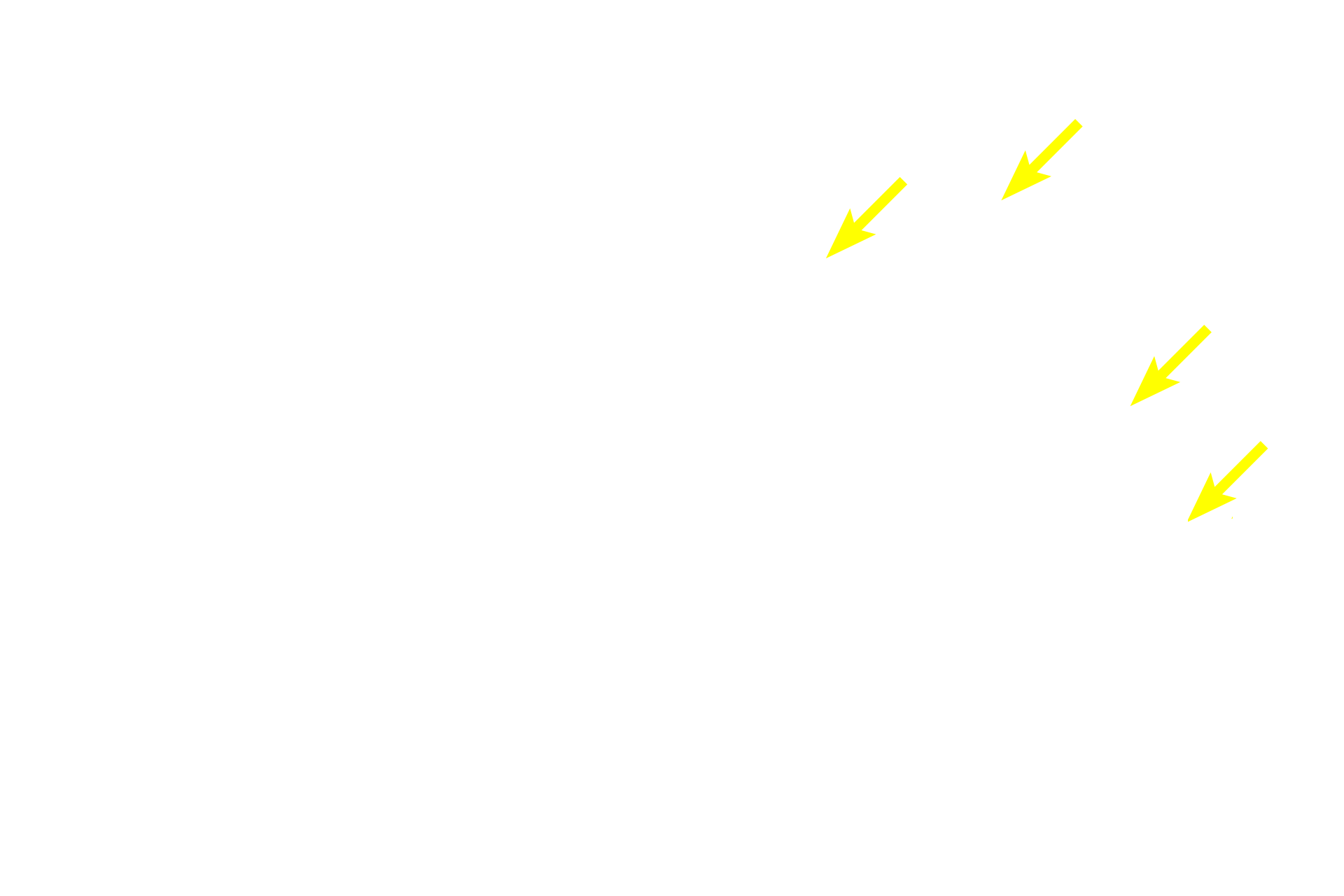  - Megakaryocytes >  <p>Megakaryocytes are large cells in the marrow that produce platelets, which are essential for blood clotting.  Platelets are cell fragments shed from megakaryocytes. </p>
