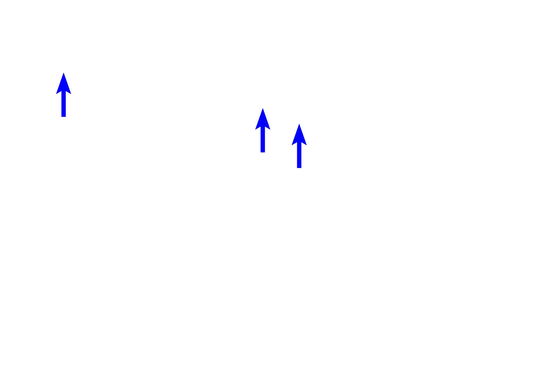 Ejaculatory ducts > <p>Ejaculatory ducts are paired structures, each formed by the union of the ductus deferens with the duct of the seminal vesicle. Ejaculatory ducts traverse the prostate gland and empty into the prostatic urethra at the seminal colliculus.</p>
