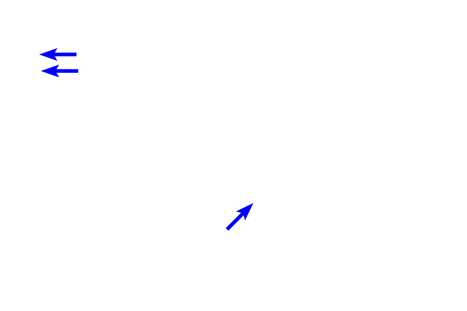 Prostatic urethra > <p>The prostatic urethra receives the secretions of the prostate gland.  It passes out of the prostate as the membranous urethra and becomes the penile (spongy) urethra that runs the length of the penis.  </p>
