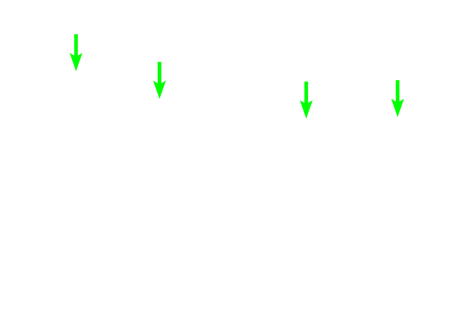 Epiphyseal plate > <p>Long bones grow in length from a plate of hyaline cartilage, called the epiphyseal plate, located between the epiphysis and the metaphysis. The plate is indicated in the decalcified section on the right; its located is indicated in the dried bone on the left.   </p>
