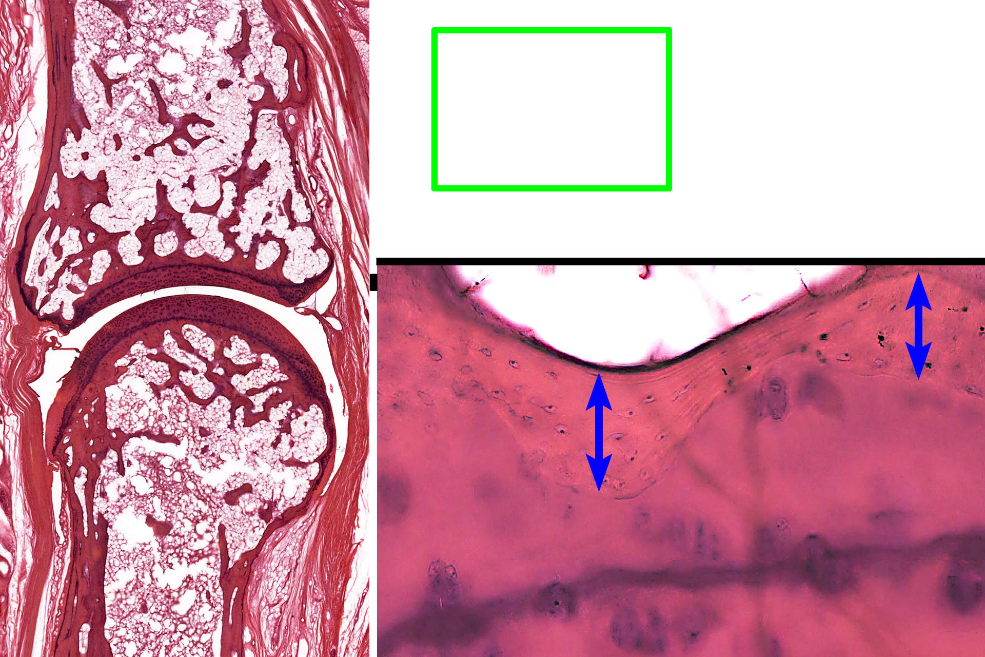  - Bone <p>This higher magnification of the area indicated by the green rectangle shows the interface of the compact bone of the epiphysis  with articular cartilage.  Osteocytes in lacuna are evident in the compact bone.</p>
