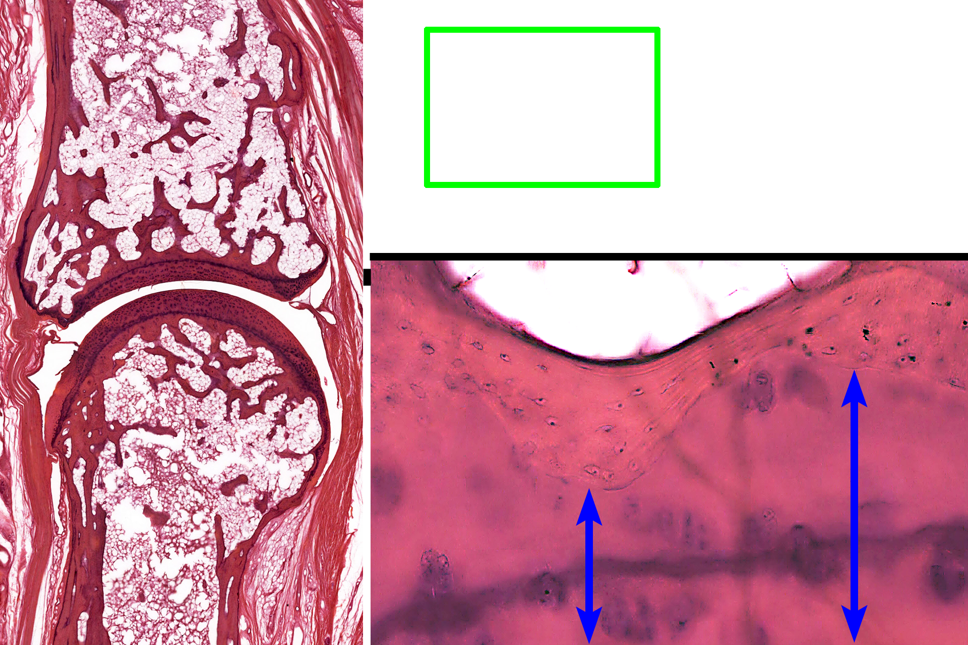  - Cartilage <p>This higher magnification of the area indicated by the green rectangle shows the interface of the compact bone of the epiphysis  with articular cartilage.  Osteocytes in lacuna are evident in the compact bone.</p>
