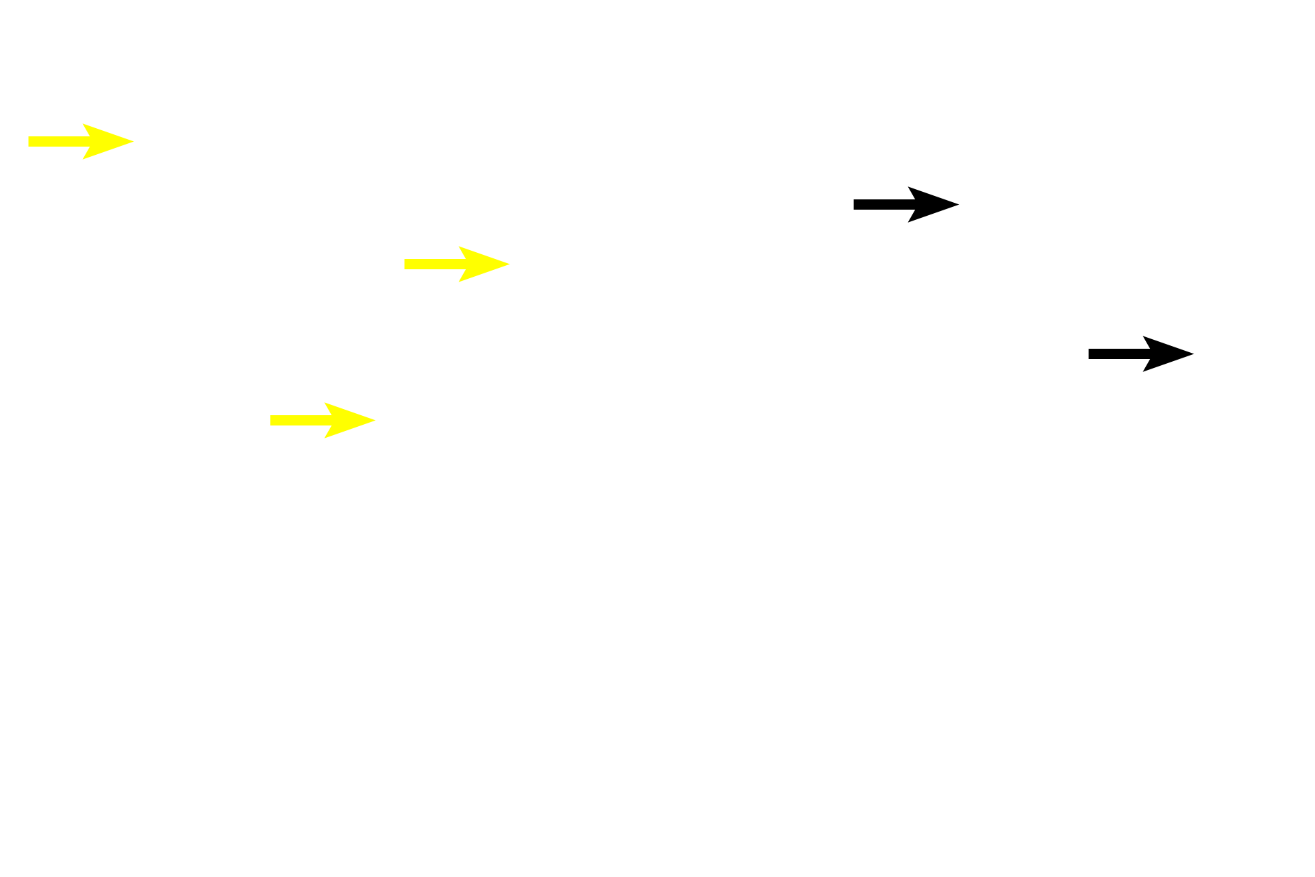 Intestinal glands <p>These images show lymphoid nodules in MALT. Nodules result from initial antigen detection in diffuse lymphoid tissues and the subsequent recruitment of additional immune cells to the region. 200x, 200x. </p>
