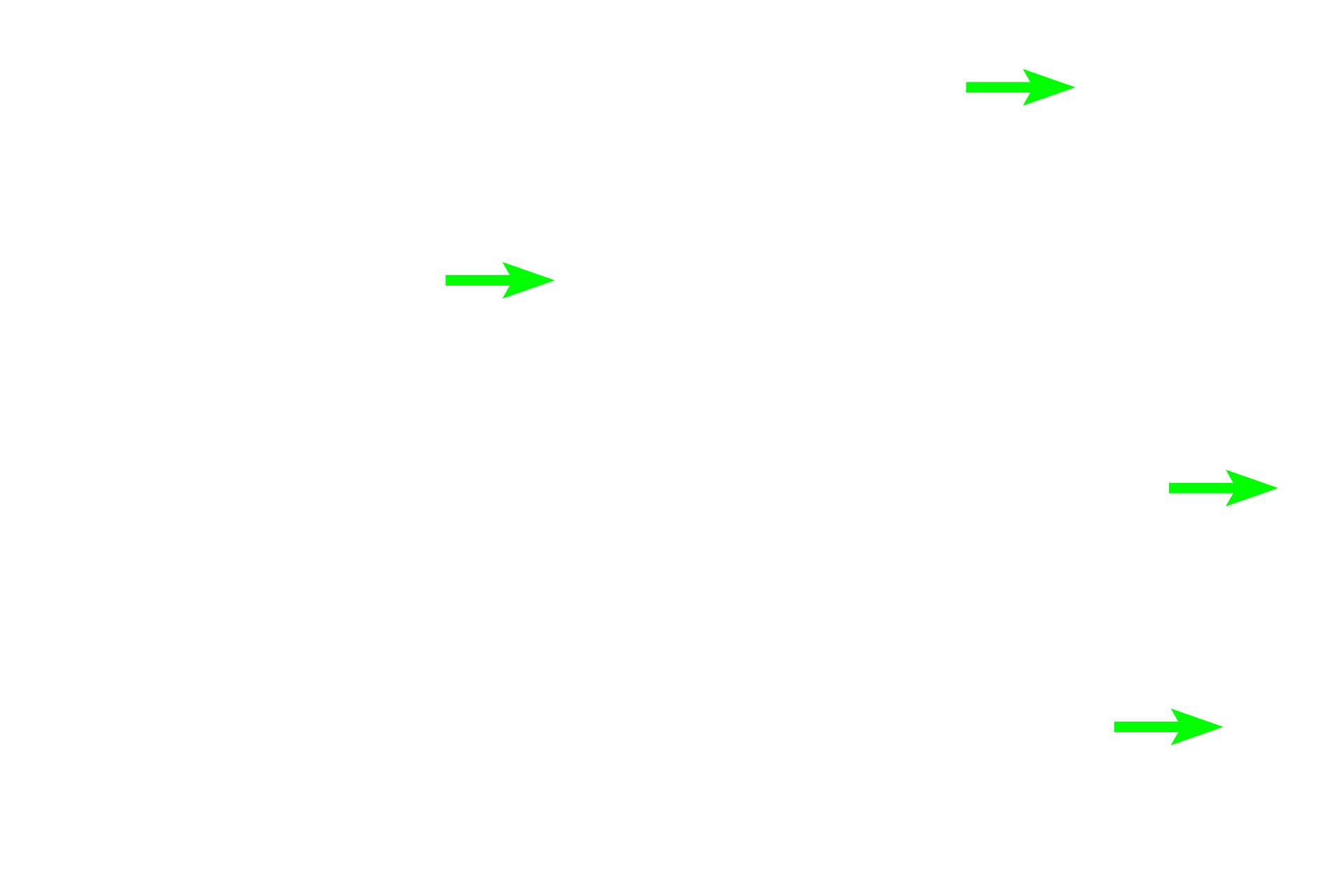 Secondary lymphoid nodules <p>Lymphoid nodules also occur in aggregates, such as Peyer’s patches in the small intestine. A single Peyer’s patch contains clusters of nodules surrounded by diffuse lymphoid tissue. Because Peyer’s patches are located in the lamina propria of the mucosa, they are part of MALT and filter tissue fluid. Peyer’s patches are most numerous in the ileum, seen here. An area similar to that outlined in the rectangle is shown at higher magnification on the right.  Ileum 40x (l); 100x (r)</p>
