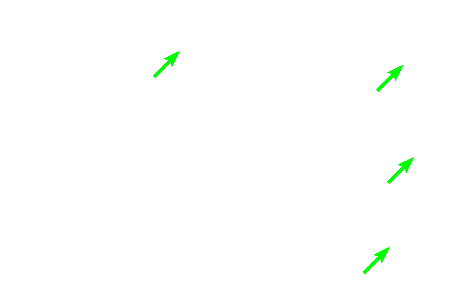 Diffuse lymphoid tissue <p>Lymphoid nodules also occur in aggregates, such as Peyer’s patches in the small intestine. A single Peyer’s patch contains clusters of nodules surrounded by diffuse lymphoid tissue. Because Peyer’s patches are located in the lamina propria of the mucosa, they are part of MALT and filter tissue fluid. Peyer’s patches are most numerous in the ileum, seen here. An area similar to that outlined in the rectangle is shown at higher magnification on the right.  Ileum 40x (l); 100x (r)</p>
