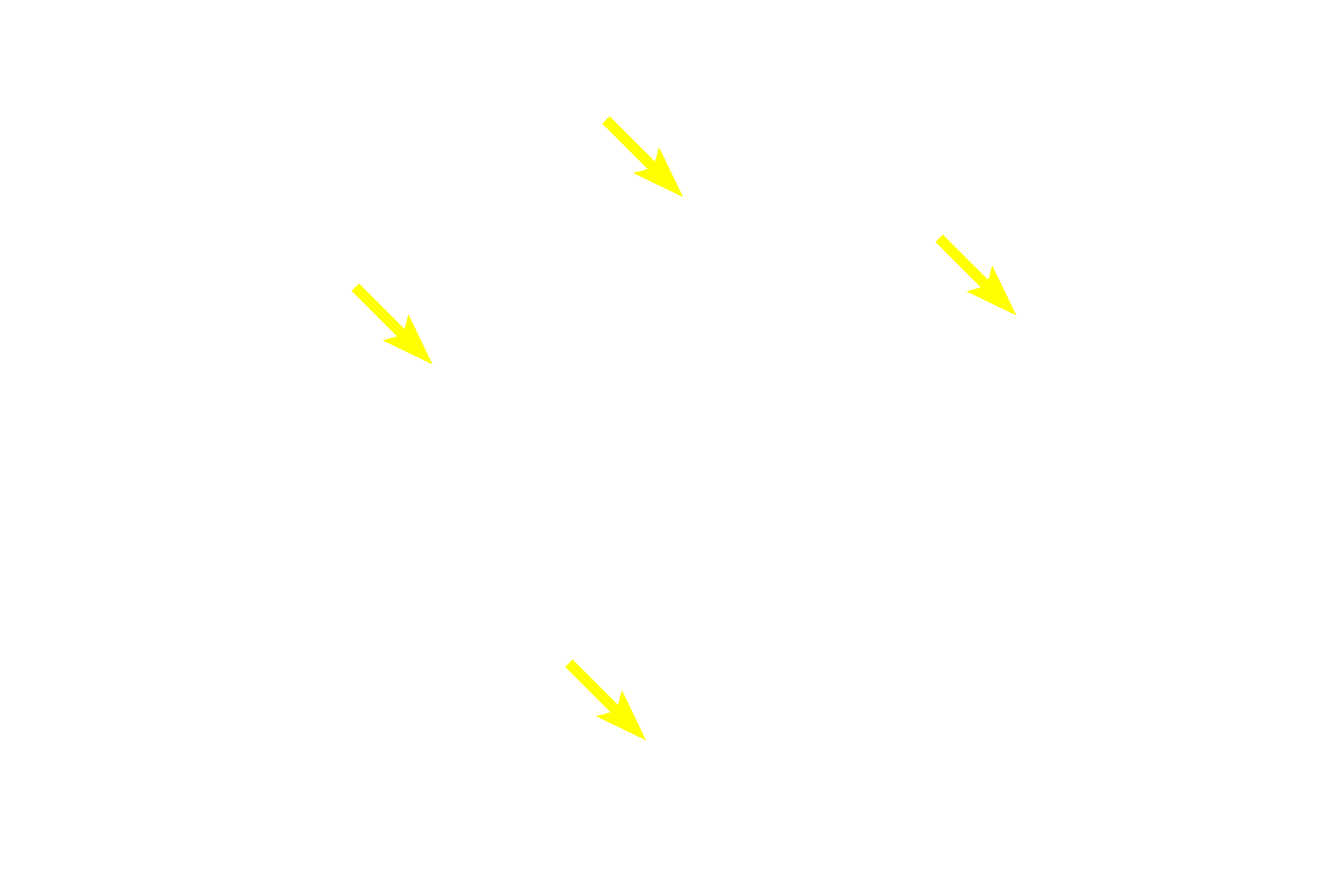  - - Germinal centers <p>The appendix is a narrow, blind-ended tube attached to the cecum, the initial region of the large intestine. Though considered a portion of the tubular digestive tract, the lamina propria of the appendix is heavily infiltrated with lymphoid tissue forming numerous secondary nodules. As such, the appendix is an important component of the mucosal immune system. 40x</p>
