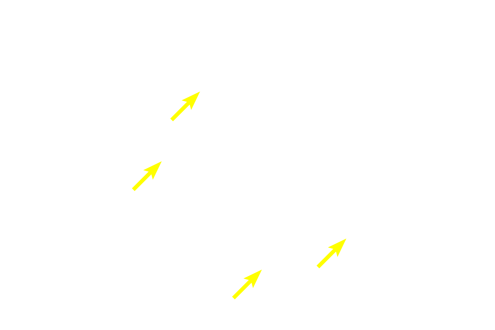  - Intestinal glands <p>The appendix is a narrow, blind-ended tube attached to the cecum, the initial region of the large intestine. Though considered a portion of the tubular digestive tract, the lamina propria of the appendix is heavily infiltrated with lymphoid tissue forming numerous secondary nodules. As such, the appendix is an important component of the mucosal immune system. 40x</p>
