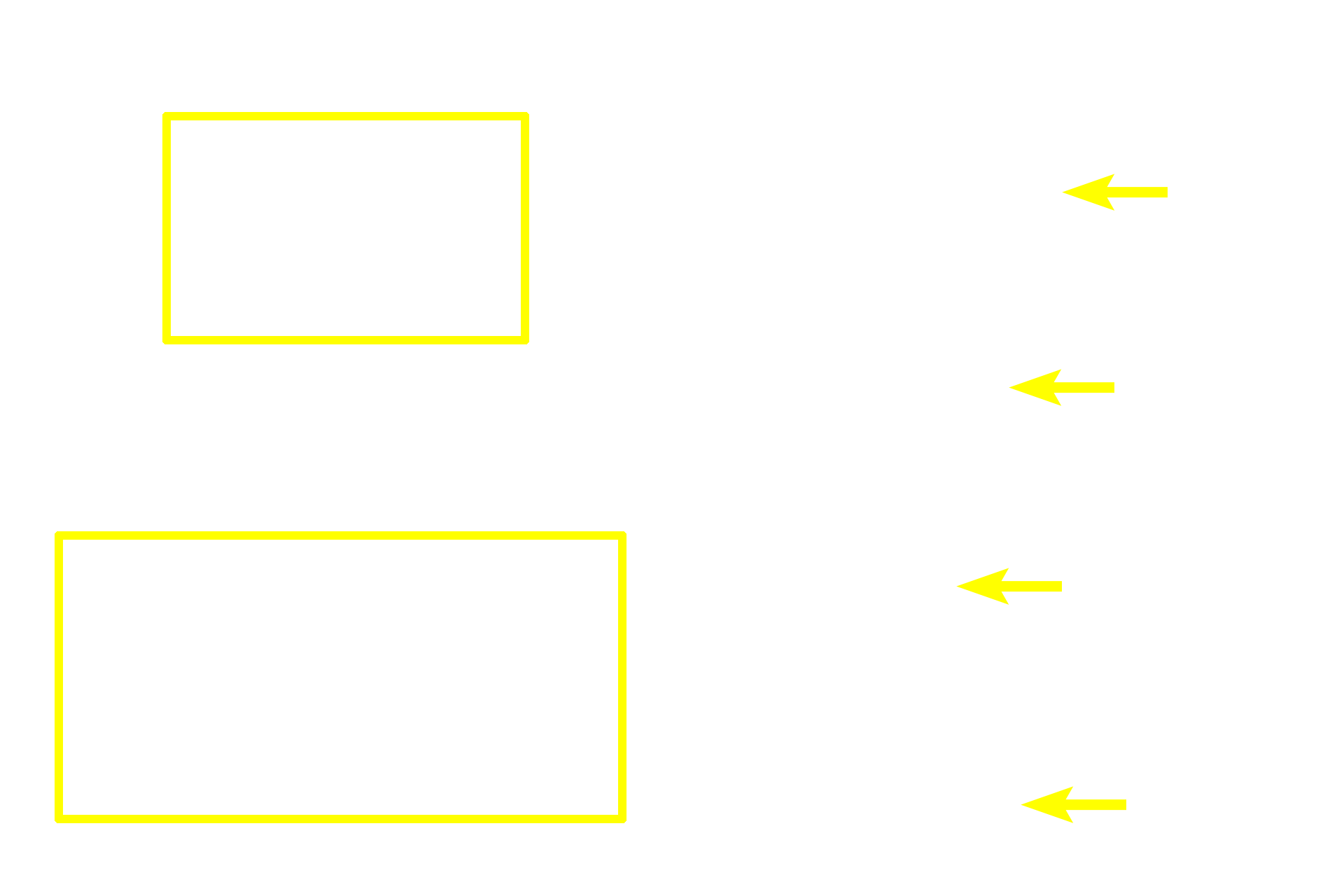 High endothelial venules <p>The structure of high endothelial venules (HEVs) is shown to advantage in these thin plastic sections. The unique cuboidal-shaped endothelial cells facilitate the migration (diapedesis) of lymphocytes from the blood into the surrounding tissues. These venules are surrounded by diffuse lymphoid tissue. HEVs are present in all secondary lymphoid tissues and organs except the spleen. The two images on the left show cross sections; the image on the right is a longitudinal section. Lymph node, 600x (left panels); 400x (right panel) </p>
