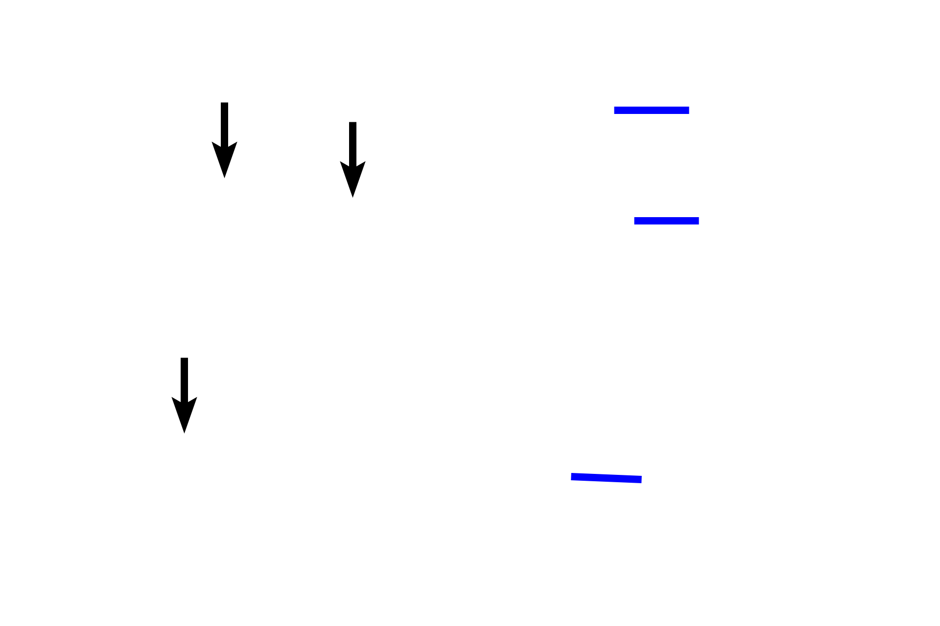 Smooth muscle layer <p>Small lymphatic capillaries anastomose to form larger lymphatic vessels that possess smooth muscle in their wall. Oriented circularly around the lumen, the smooth muscle aids in propelling lymph through the system. The outer layer of the vessel consists of an adventitia composed of connective tissue. 200x (l); 600x (r).</p>
