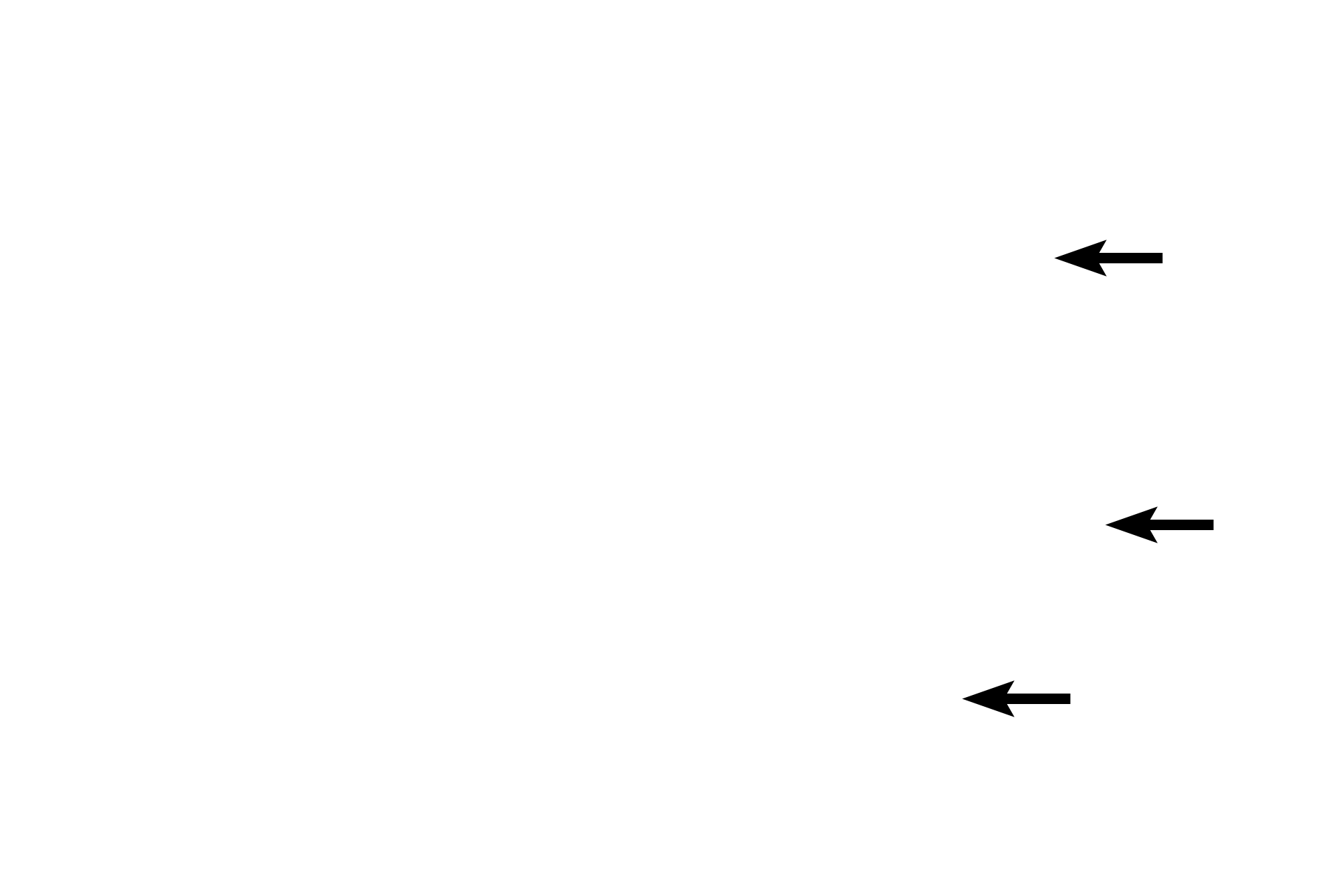  - Endothelial cells <p>In larger vessels, valve leaflets are supported by a core of connective tissue.</p>
