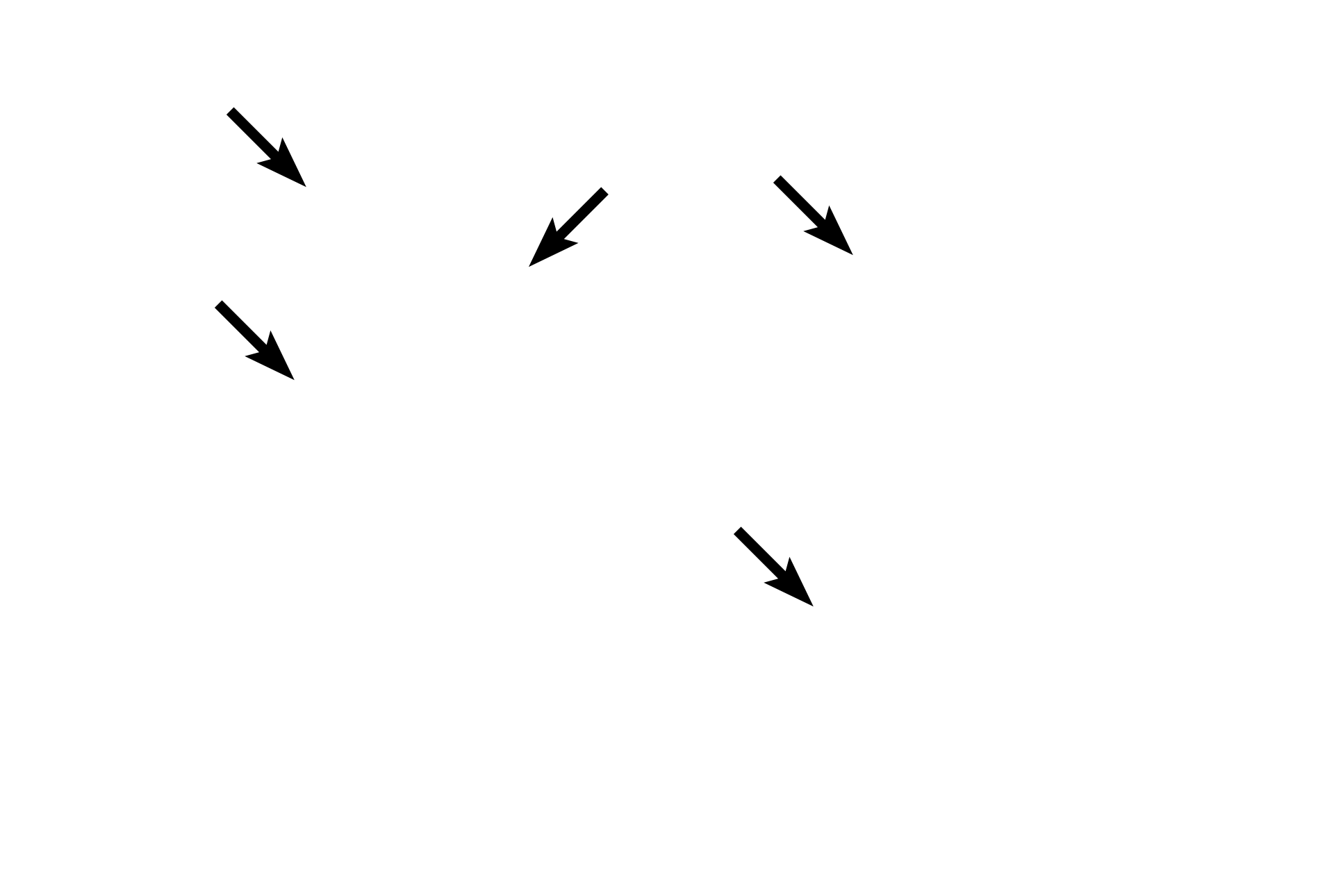Adventitia <p>Small lymphatic capillaries anastomose to form larger lymphatic vessels that possess smooth muscle in their wall. Oriented circularly around the lumen, the smooth muscle aids in propelling lymph through the system. The outer layer of the vessel consists of an adventitia composed of connective tissue. 200x (l); 600x (r).</p>
