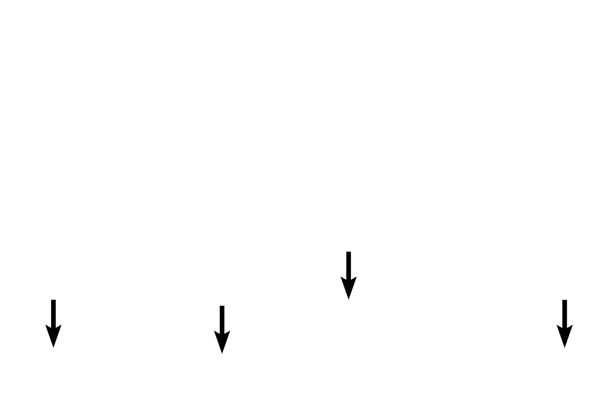 Muscularis mucosae <p>Primary lymphoid nodules consists of a spherical mass of unstimulated lymphocytes. These primary nodules, located in the lamina propria of the colon (l) and stomach (r), filter tissue fluid and respond to antigens encountered by the mucosa.  Following antigen stimulation, they can become a secondary nodule with the formation of a pale staining central region called the germinal center.</p>
