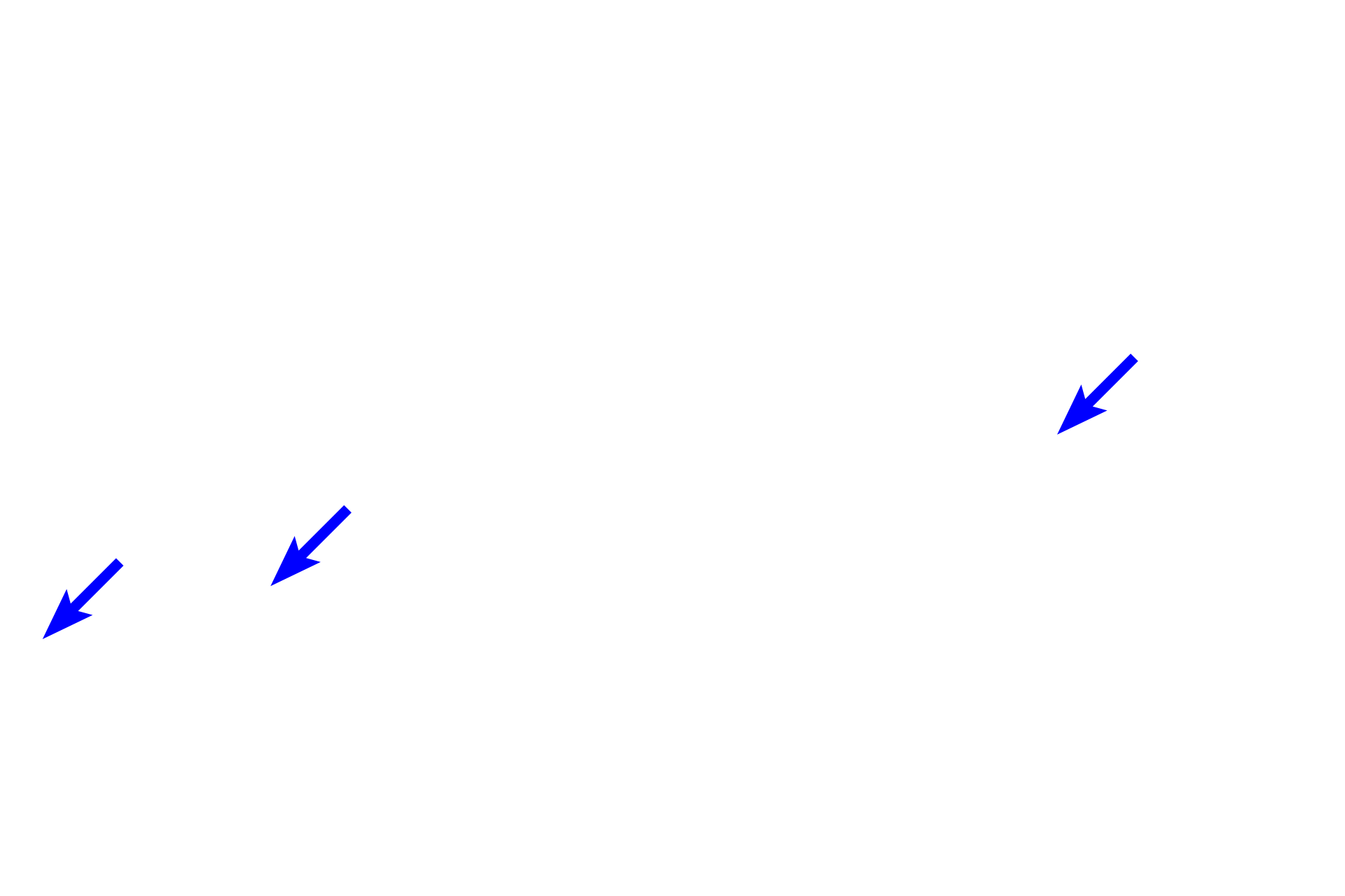  - Muscularis mucosae <p>With antigenic stimulation, primary nodules increase in size and develop a pale-staining central region called the germinal center. These are now referred to as secondary nodules. Germinal centers are a morphological indication of lymphoid tissue response to antigen and represent a cascade of events including activation and proliferation of lymphocytes, and generation of plasma cells and memory B cells. Colon, 200x</p>
