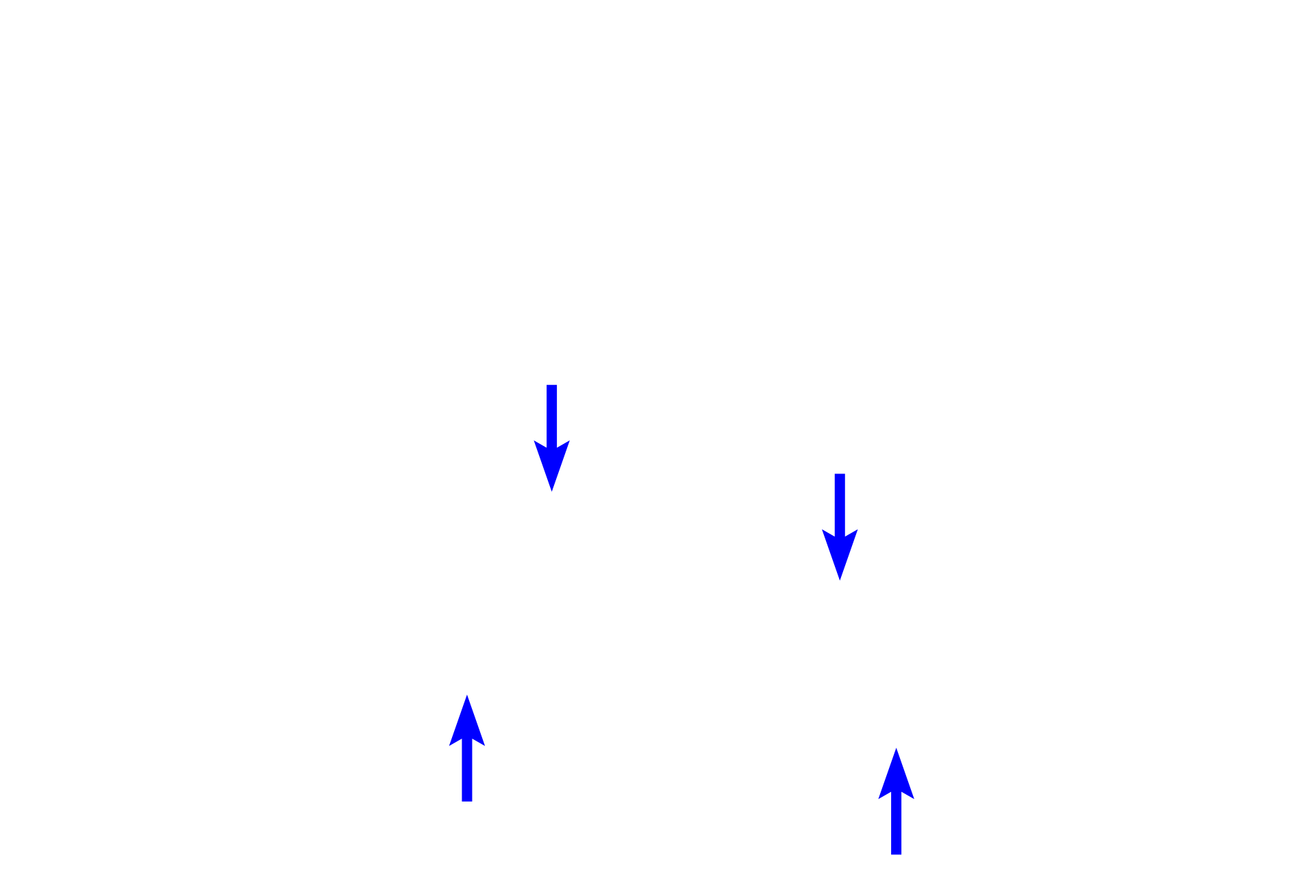  - Mantle <p>This larger secondary nodule shows an early germinal center surrounded by a mantle of small, unstimulated B lymphocytes. Here, the nodule has infiltrated the muscularis mucosae. Colon, 200x</p>
