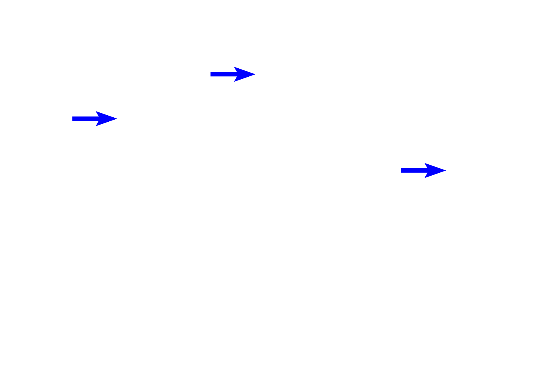 Intestinal glands <p>This larger secondary nodule shows an early germinal center surrounded by a mantle of small, unstimulated B lymphocytes. Here, the nodule has infiltrated the muscularis mucosae. Colon, 200x</p>

