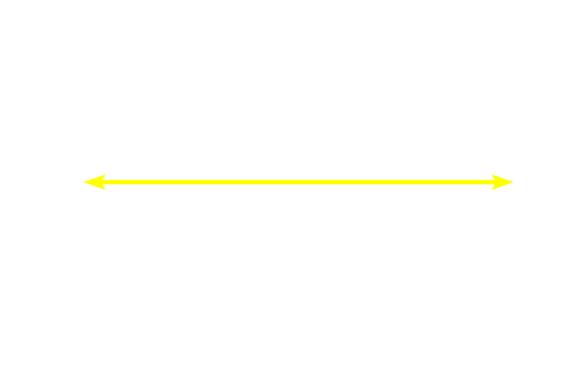 Secondary nodule <p>This secondary nodule demonstrates the zonation visible within the germinal center. In the dark zone, B cells proliferate and undergo random mutations of their antibody-producing genes. These B cells are then selected in the light zone, based on their antibody’s ability to bind to an antigen. Those with high-affinity antibodies undergo further proliferation and form large, pale-staining immunoblasts. Prodigy of these cells become plasma cells and B memory cells. Cells with disadvantageous mutations are eliminated by apoptosis and phagocytosis by macrophages. Lymph node, 200x</p>
