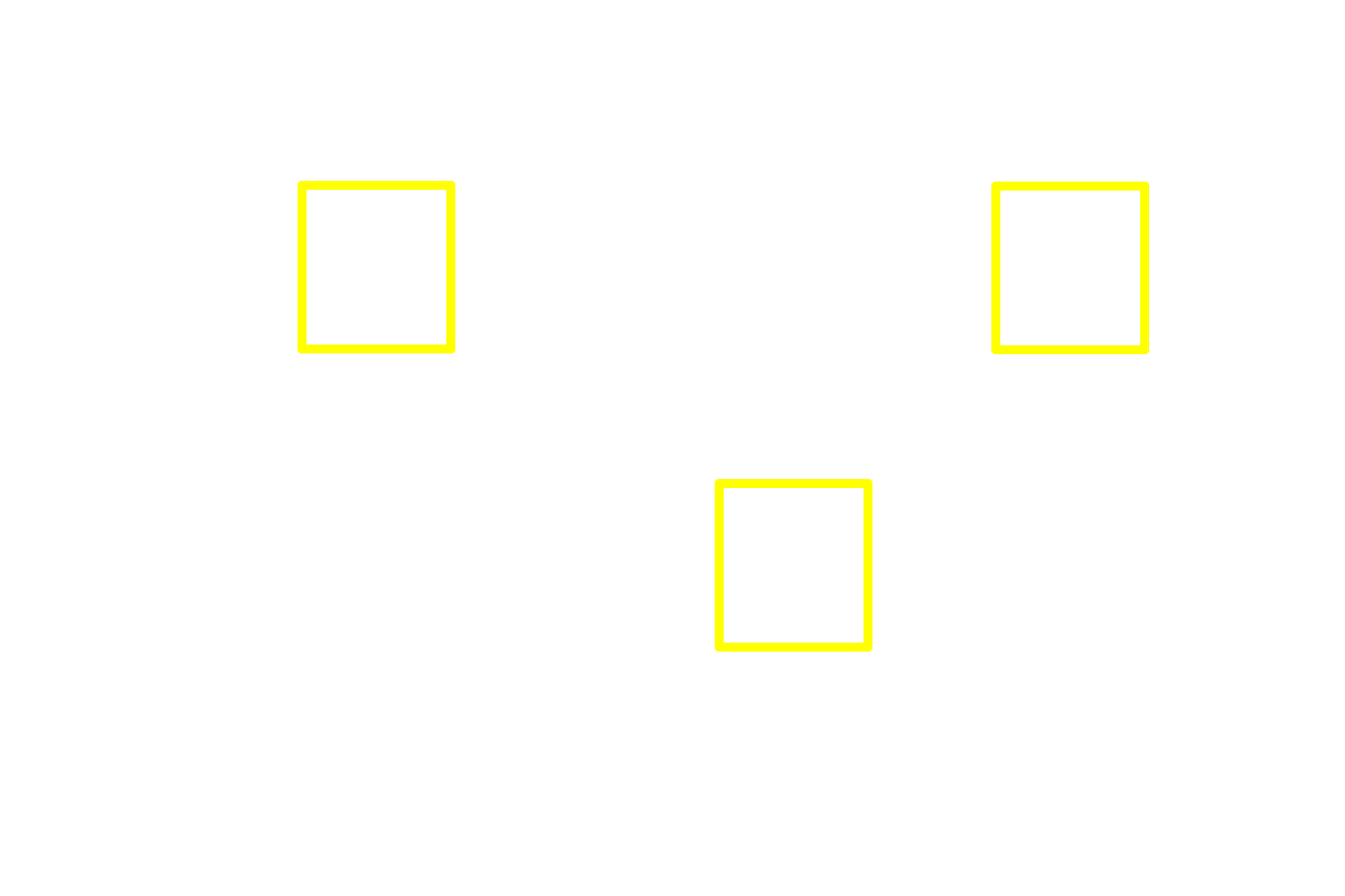 Tingible body macrophages <p>In the germinal center, B cells proliferate, altering their antibody-producing genes to diversify the humoral immune response. The cells then undergo a selection process whereby only those with the highest affinity antibodies survive to form immunoblasts. The remaining cells are eliminated through apoptosis and subsequent phagocytosis by macrophages. These macrophages are termed tingible body macrophages because the phagocytosed remnants of the B cells in their cytoplasm are readily stainable. 1000x  </p>
