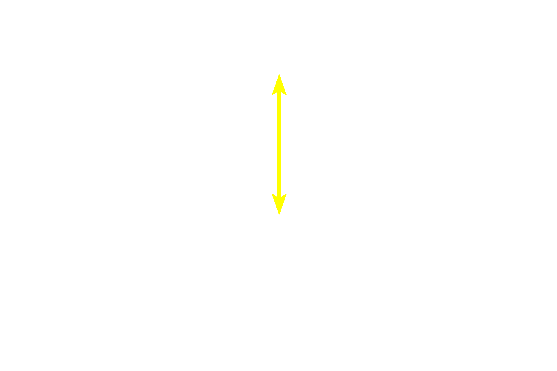  - Light zone <p>This secondary nodule demonstrates the zonation visible within the germinal center. In the dark zone, B cells proliferate and undergo random mutations of their antibody-producing genes. These B cells are then selected in the light zone, based on their antibody’s ability to bind to an antigen. Those with high-affinity antibodies undergo further proliferation and form large, pale-staining immunoblasts. Prodigy of these cells become plasma cells and B memory cells. Cells with disadvantageous mutations are eliminated by apoptosis and phagocytosis by macrophages. Lymph node, 200x</p>
