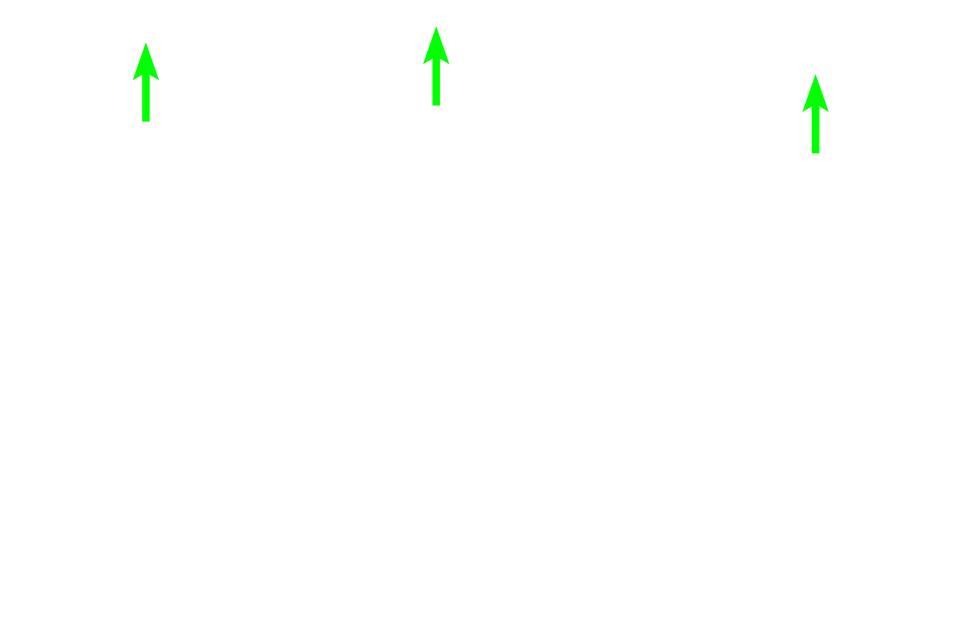 Capsule <p>This secondary nodule demonstrates the zonation visible within the germinal center. In the dark zone, B cells proliferate and undergo random mutations of their antibody-producing genes. These B cells are then selected in the light zone, based on their antibody’s ability to bind to an antigen. Those with high-affinity antibodies undergo further proliferation and form large, pale-staining immunoblasts. Prodigy of these cells become plasma cells and B memory cells. Cells with disadvantageous mutations are eliminated by apoptosis and phagocytosis by macrophages. Lymph node, 200x</p>
