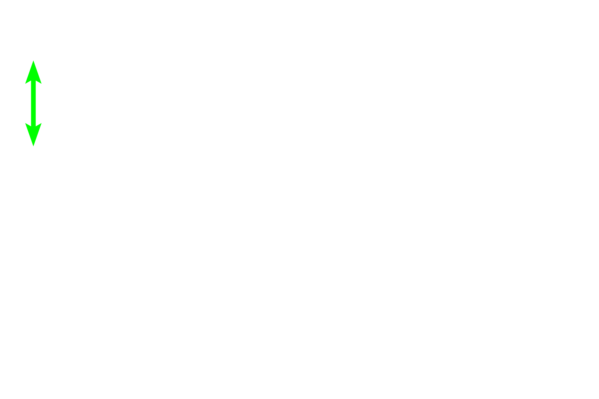 Subcapsular sinus <p>This secondary nodule demonstrates the zonation visible within the germinal center. In the dark zone, B cells proliferate and undergo random mutations of their antibody-producing genes. These B cells are then selected in the light zone, based on their antibody’s ability to bind to an antigen. Those with high-affinity antibodies undergo further proliferation and form large, pale-staining immunoblasts. Prodigy of these cells become plasma cells and B memory cells. Cells with disadvantageous mutations are eliminated by apoptosis and phagocytosis by macrophages. Lymph node, 200x</p>
