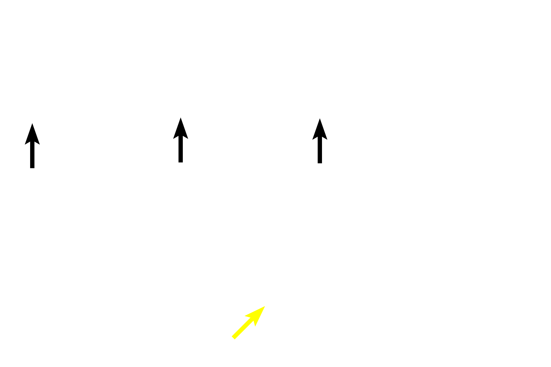 Inner table <p>Bones that form the cranial vault or calvarium (e.g., frontal and parietal bones) are classified as flat bones. Cranial bones consist of an inner diploë of spongy bone sandwiched between inner and outer tables of compact bone. This structure reflects the embryonic process by which these bones form. Additional flat bones include sternum, ribs, scapula and pelvis (e.g., ilium). 10x (top)	</p>
