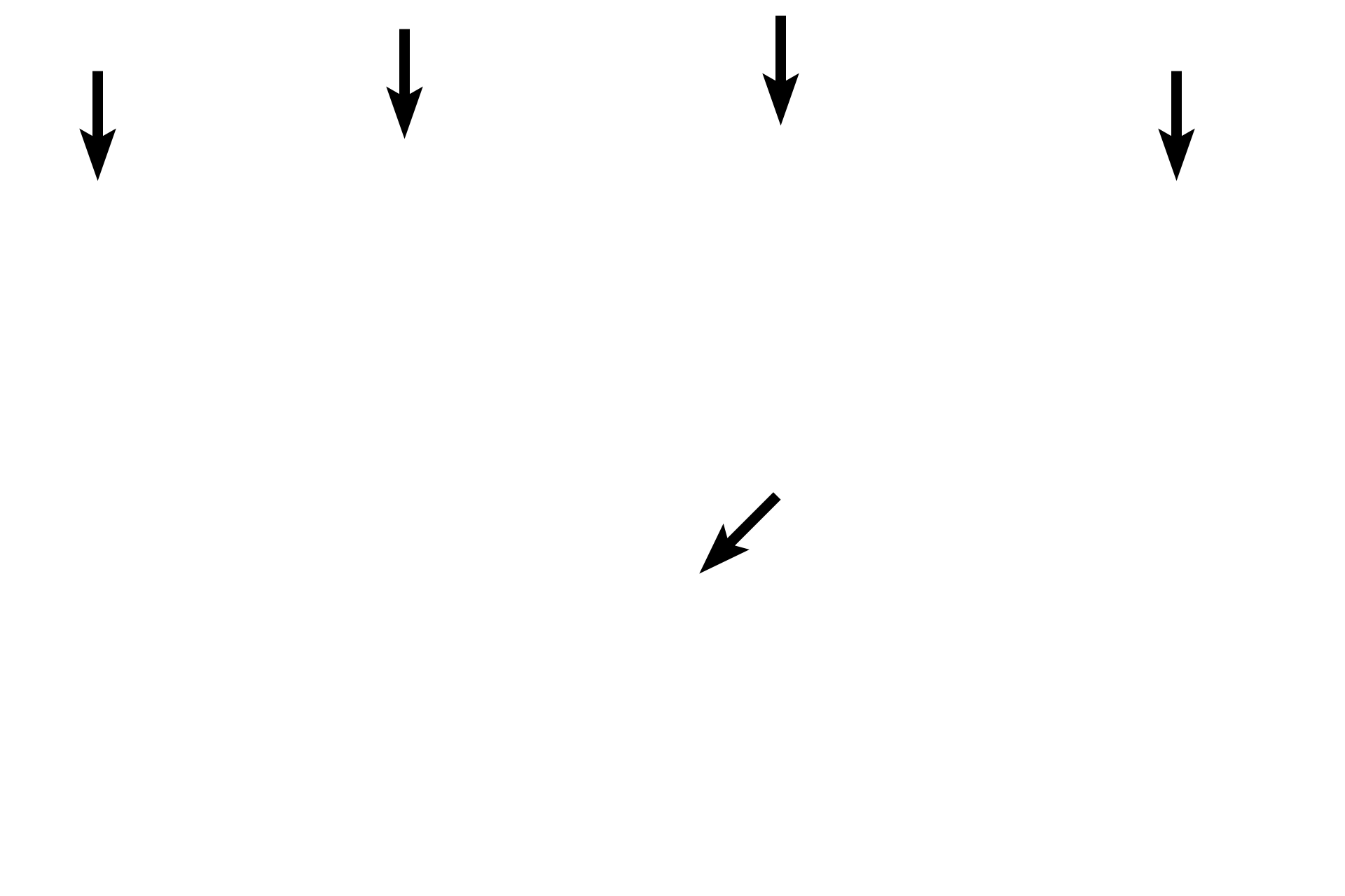 Outer table <p>Bones that form the cranial vault or calvarium (e.g., frontal and parietal bones) are classified as flat bones. Cranial bones consist of an inner diploë of spongy bone sandwiched between inner and outer tables of compact bone. This structure reflects the embryonic process by which these bones form. Additional flat bones include sternum, ribs, scapula and pelvis (e.g., ilium). 10x (top)	</p>
