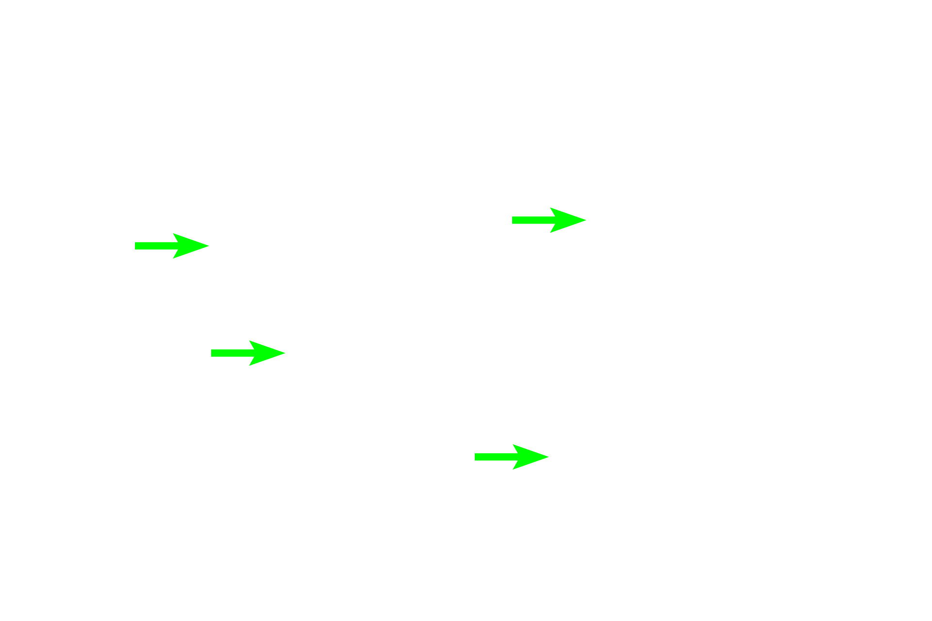 Osteoblasts > <p>Osteoblasts are depositing osteoid on the surface of the spicule.</p>
