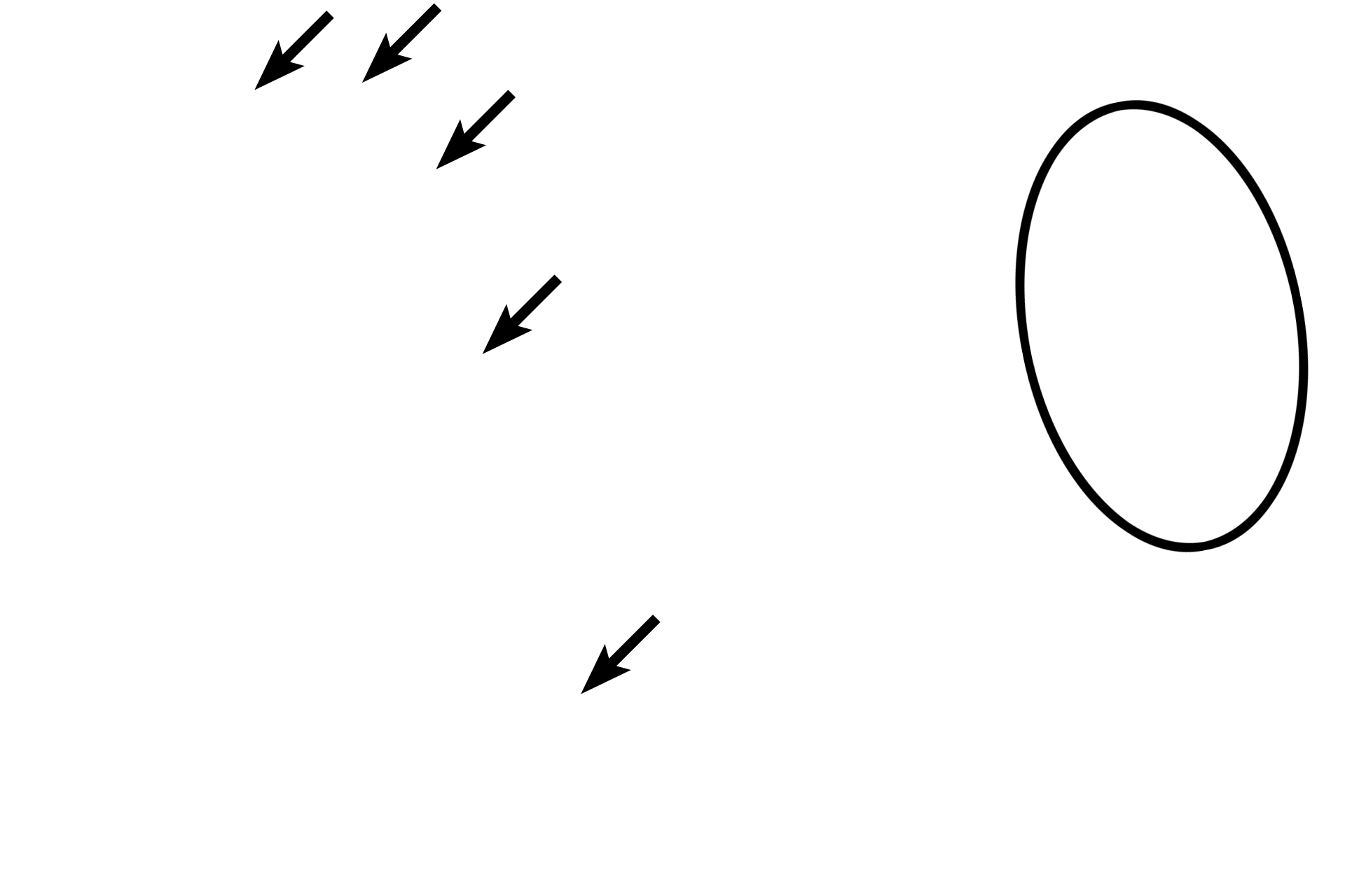 Osteoclasts <p>These spicules of bone are being resorbed by osteoclasts; large, motile cells with multiple nuclei. Throughout life, bone is resorbed and deposited to both renew and repair the matrix and to respond to mechanical stresses. Resorption results in the formation of depressions in the bone called Howship’s lacunae. Osteoclasts belong to the monocyte lineage and are not related to osteoblasts or osteocytes. Spongy bone, 400x, 1000x</p>
